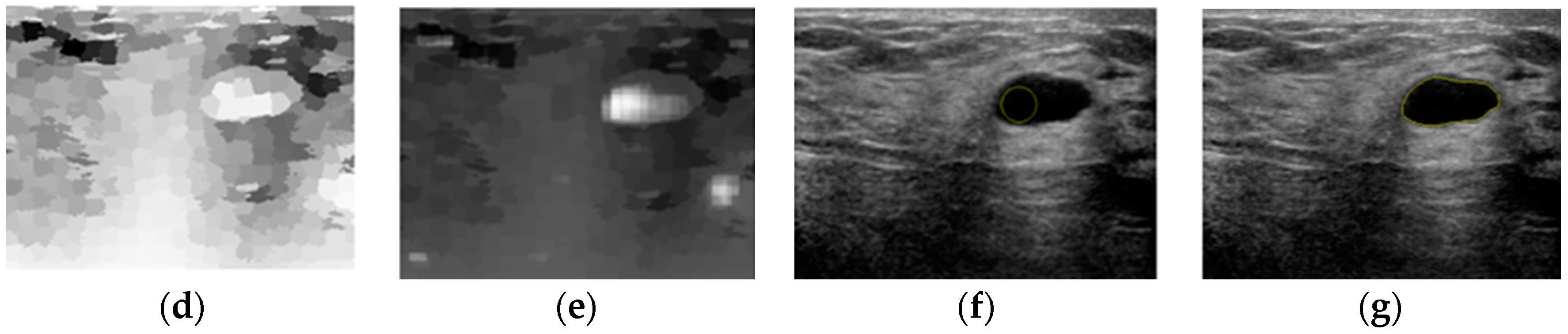 Sensors 17 01101 g012b