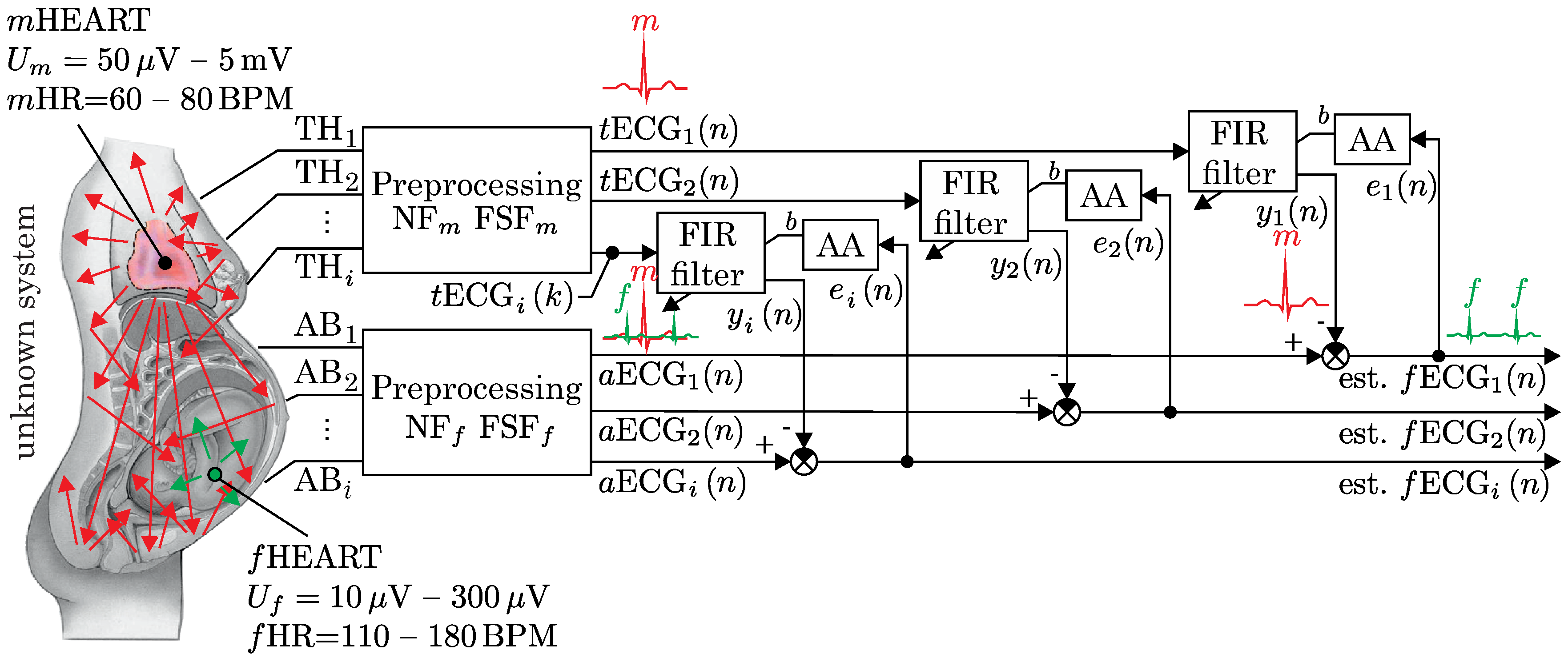 Sensors 17 01154 g004