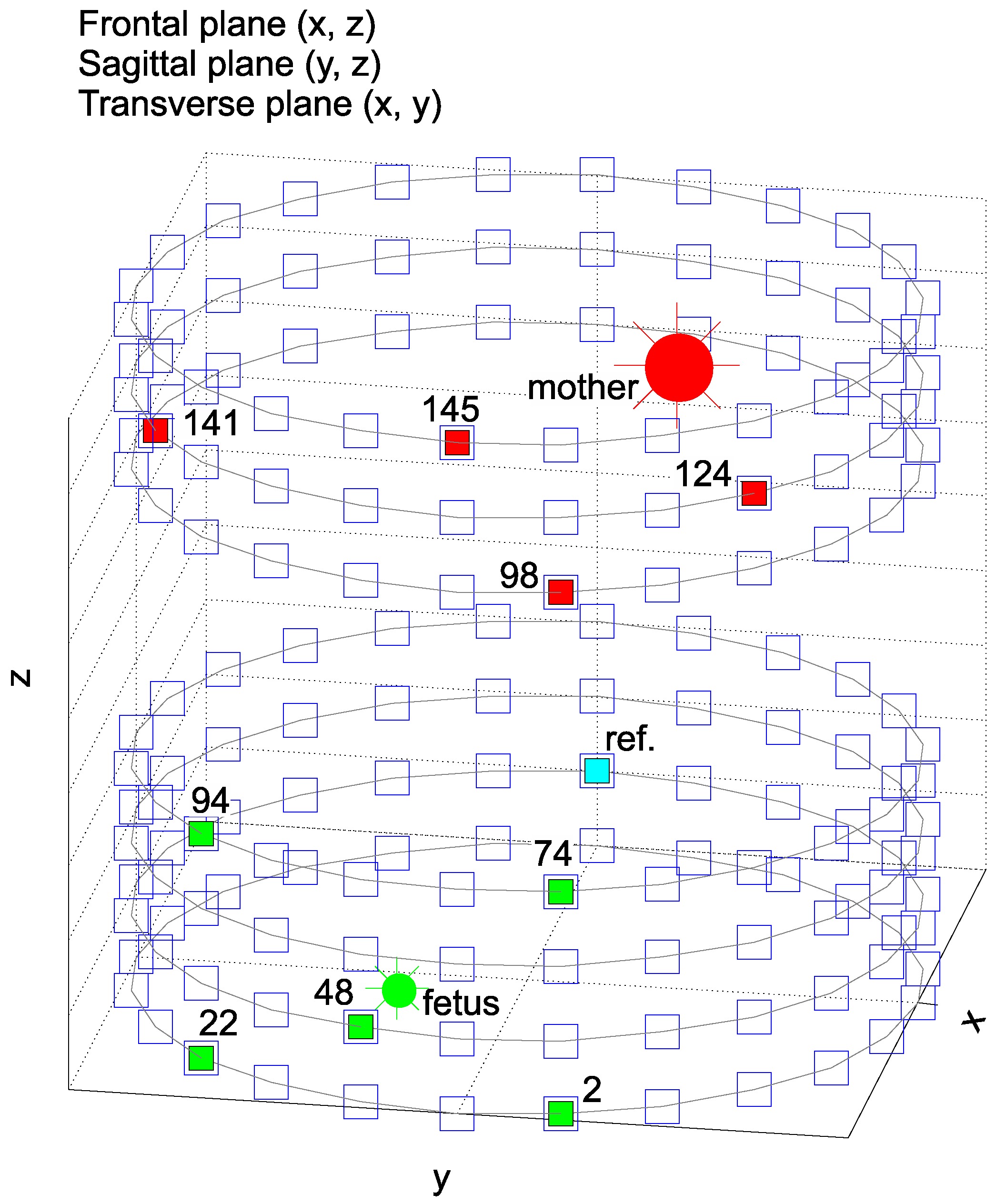 Sensors 17 01154 g006