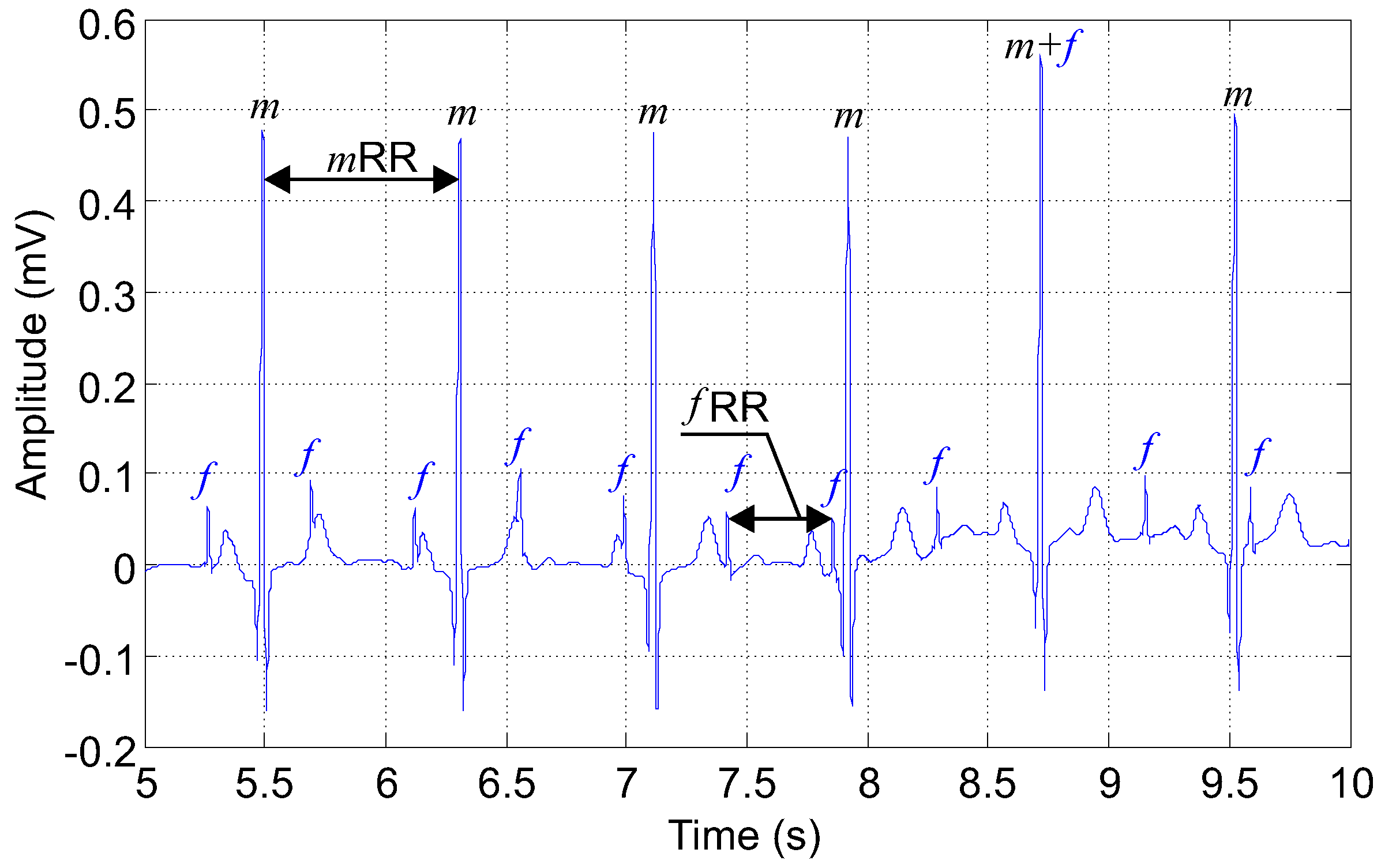 Sensors 17 01154 g007