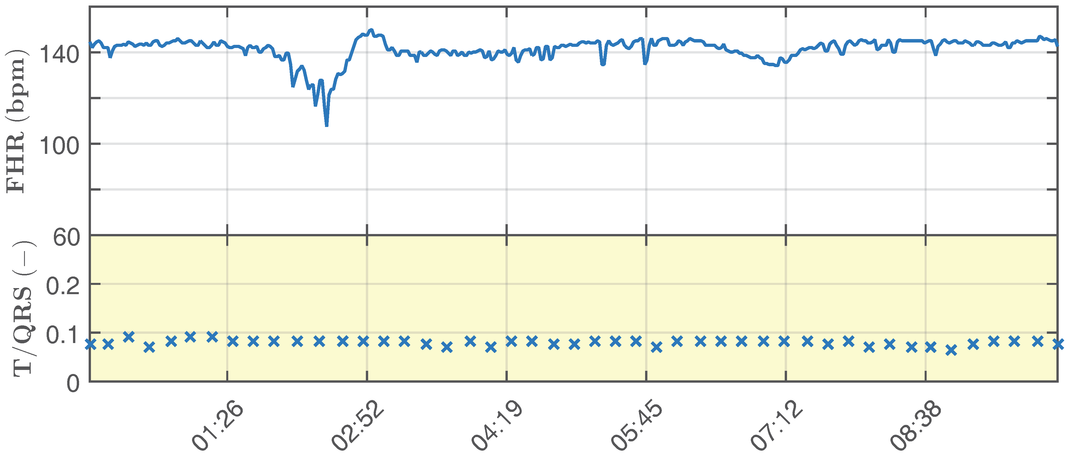 Sensors 17 01154 g008