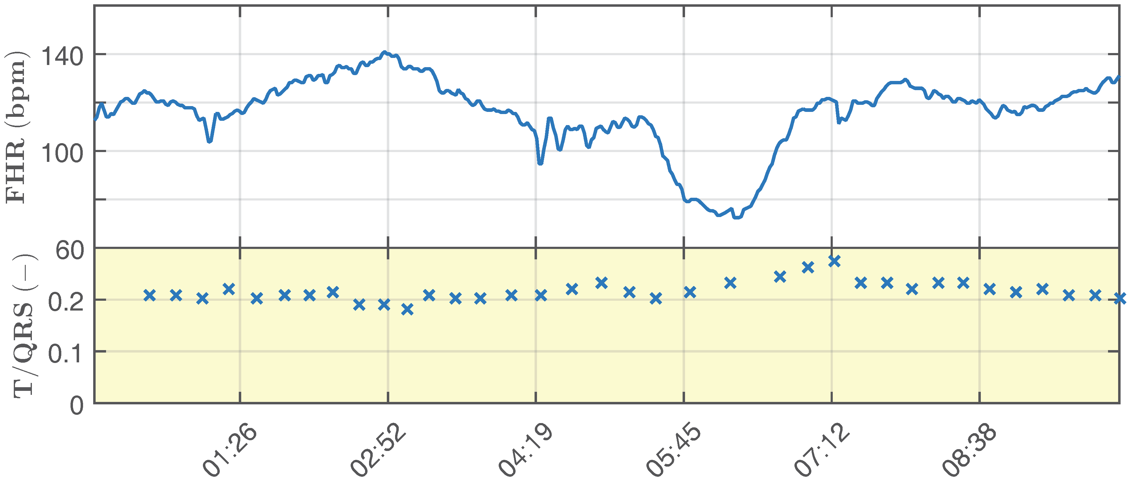 Sensors 17 01154 g009