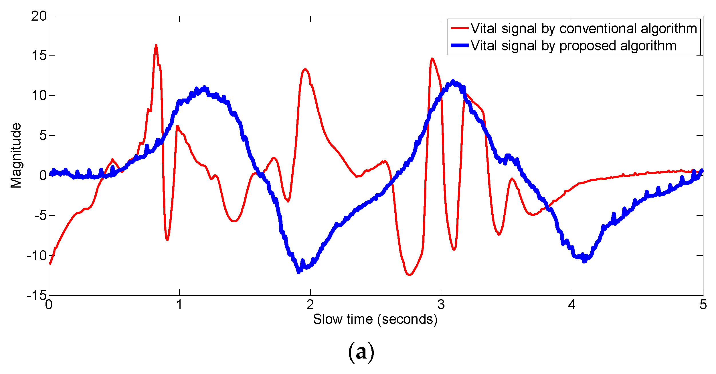 Sensors 17 01240 g016a