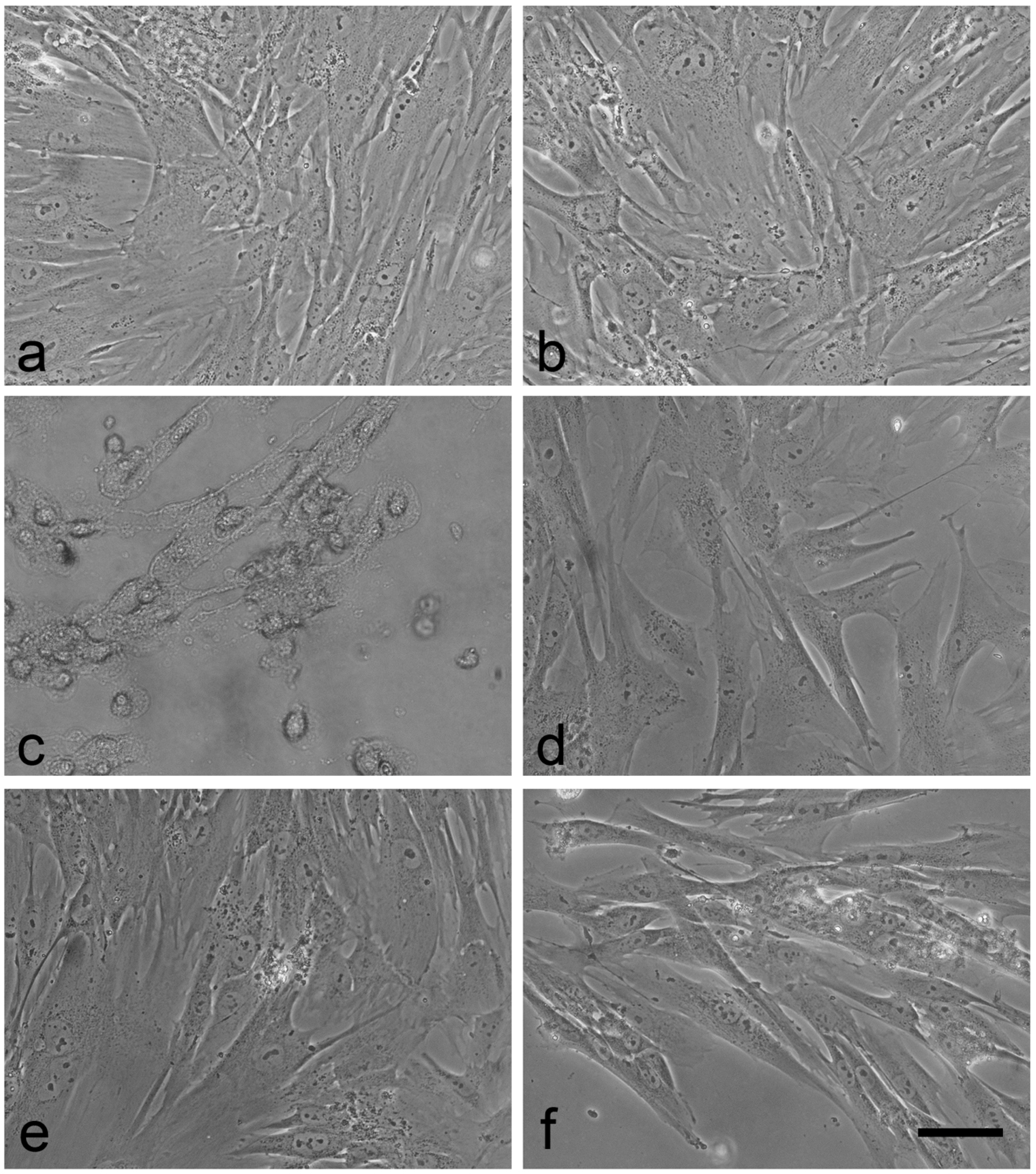 Sensors 17 01365 g005