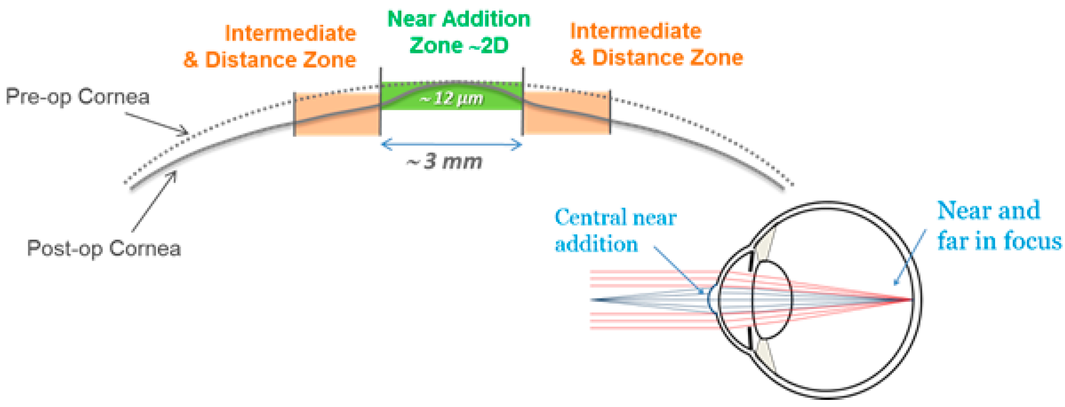 Sensors 17 01367 g001
