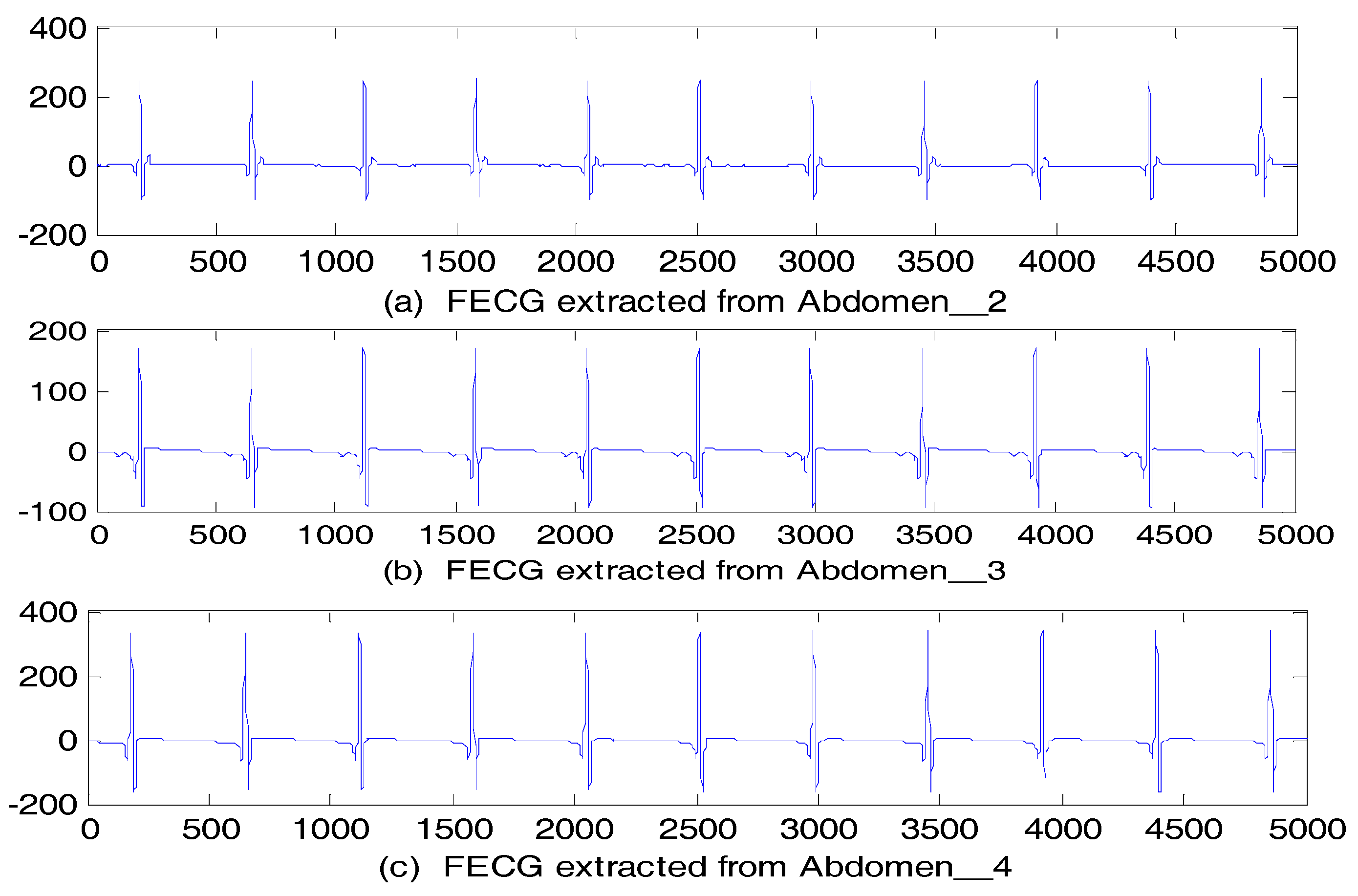 Sensors 17 01456 g013