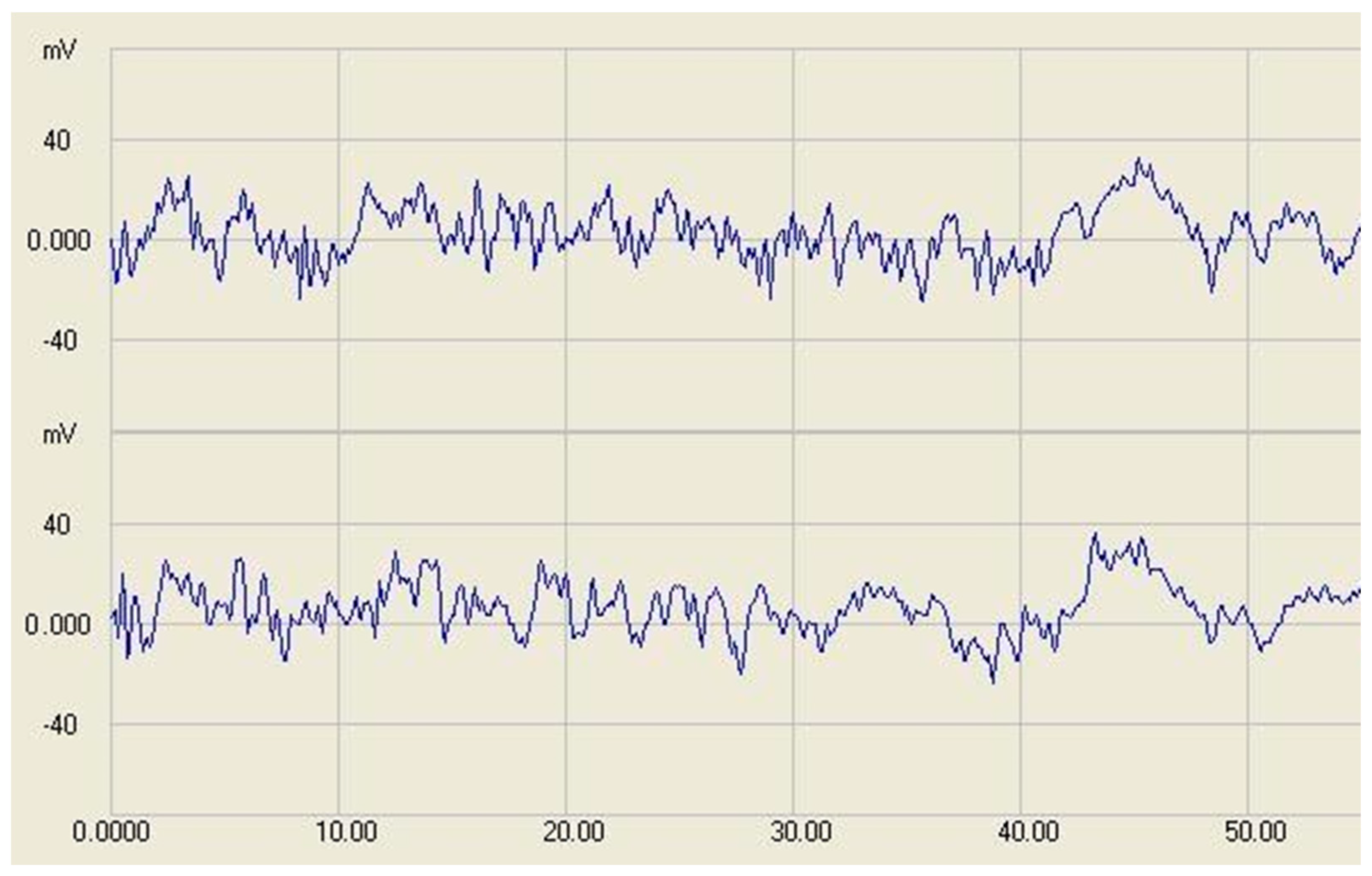 Sensors 17 01757 g004
