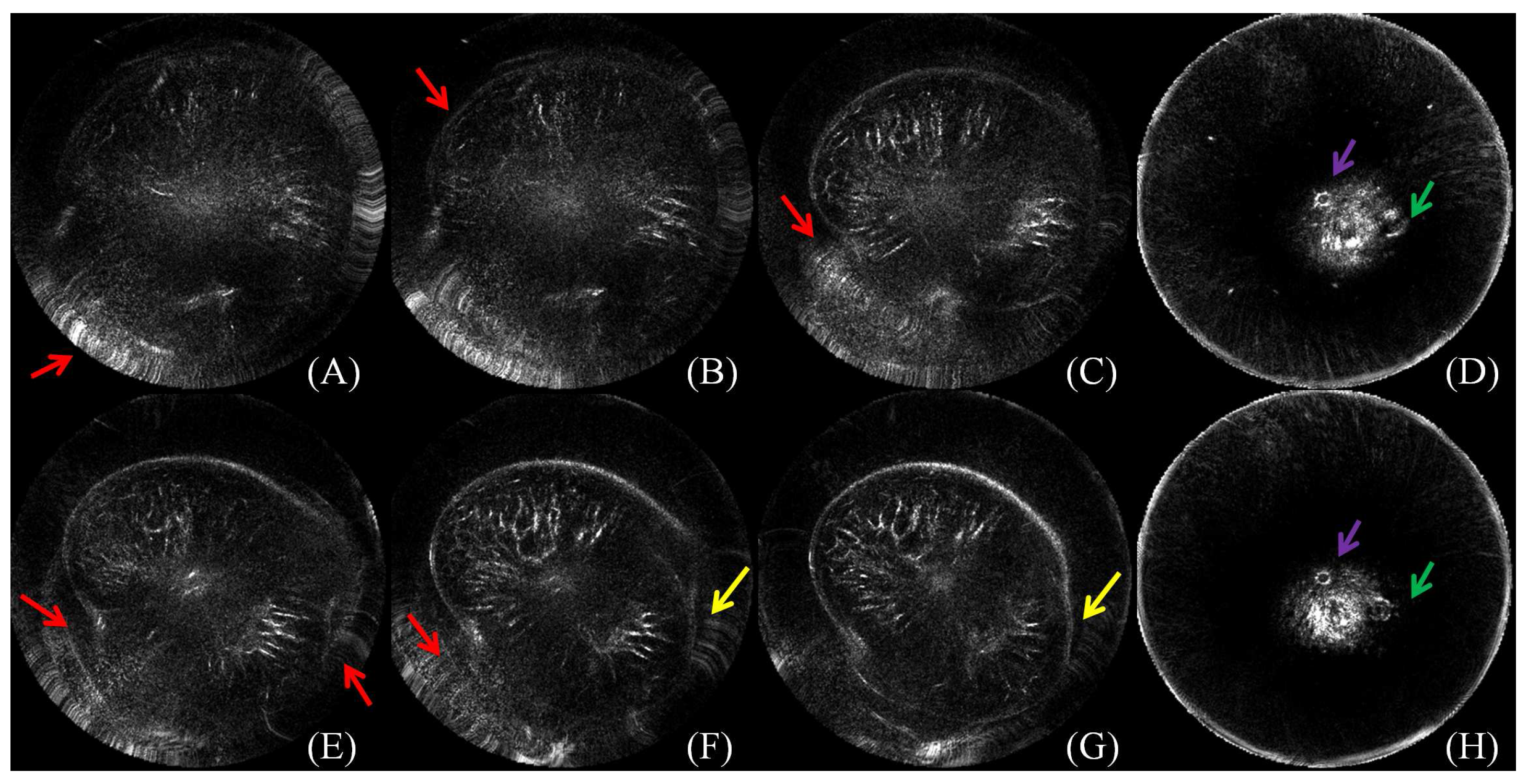 Sensors 17 01827 g001