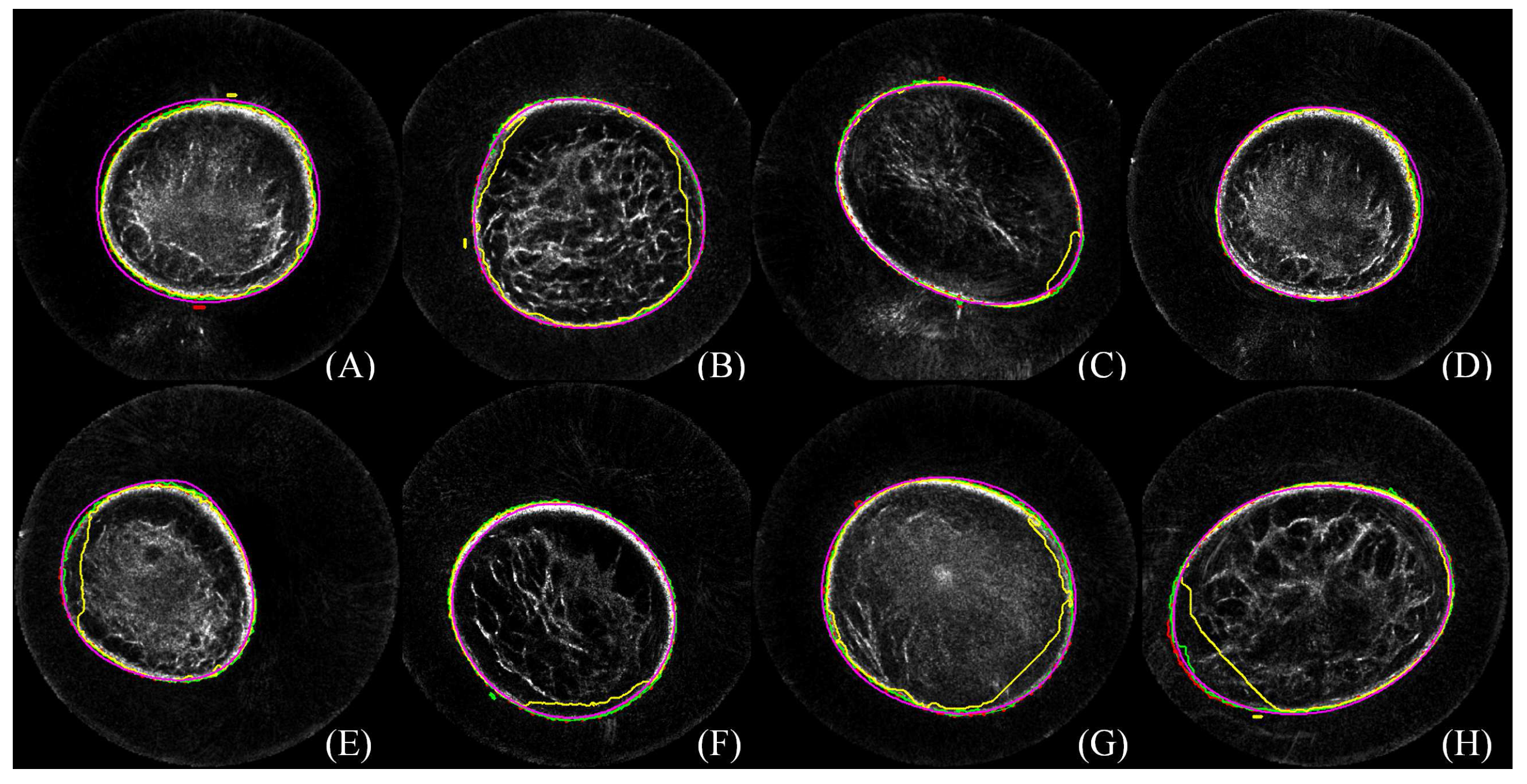 Sensors 17 01827 g005
