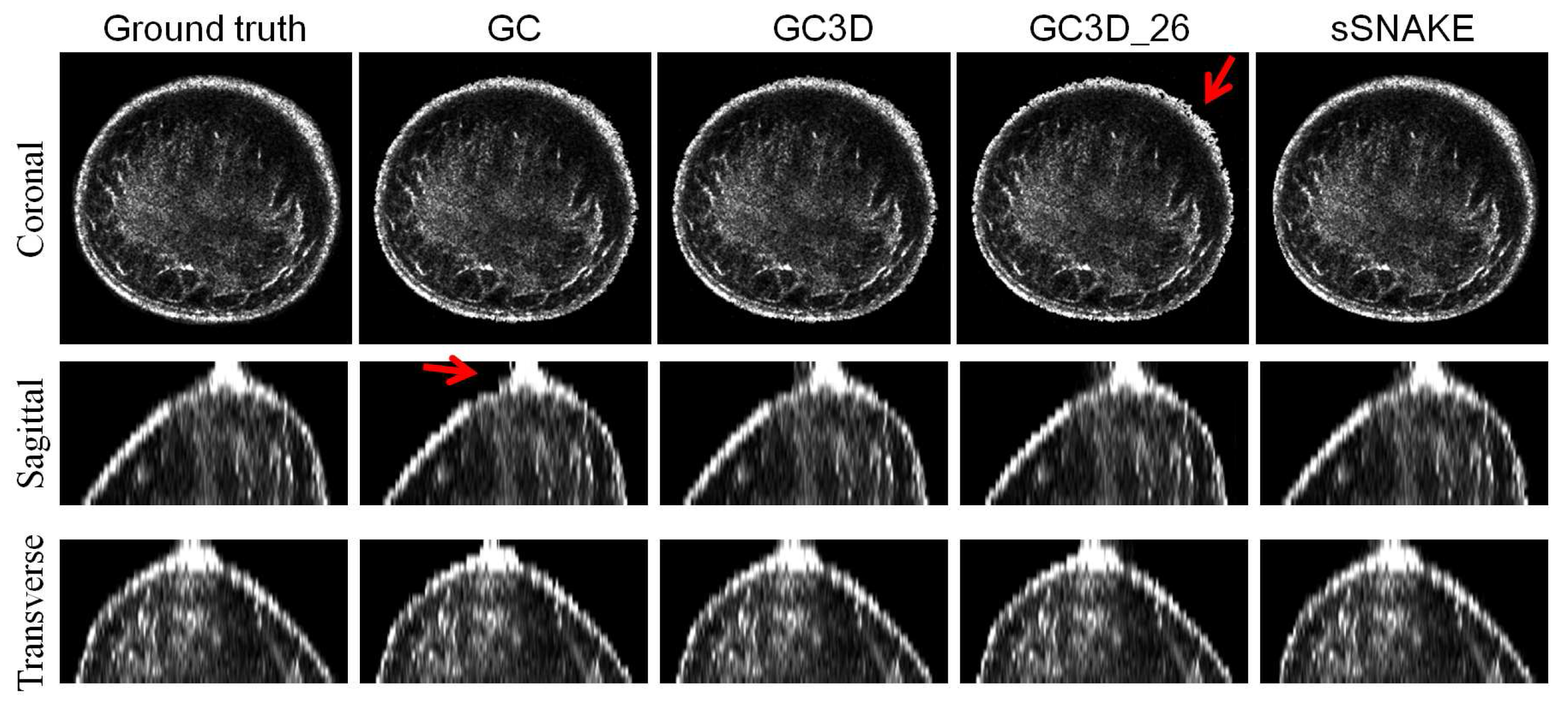 Sensors 17 01827 g006