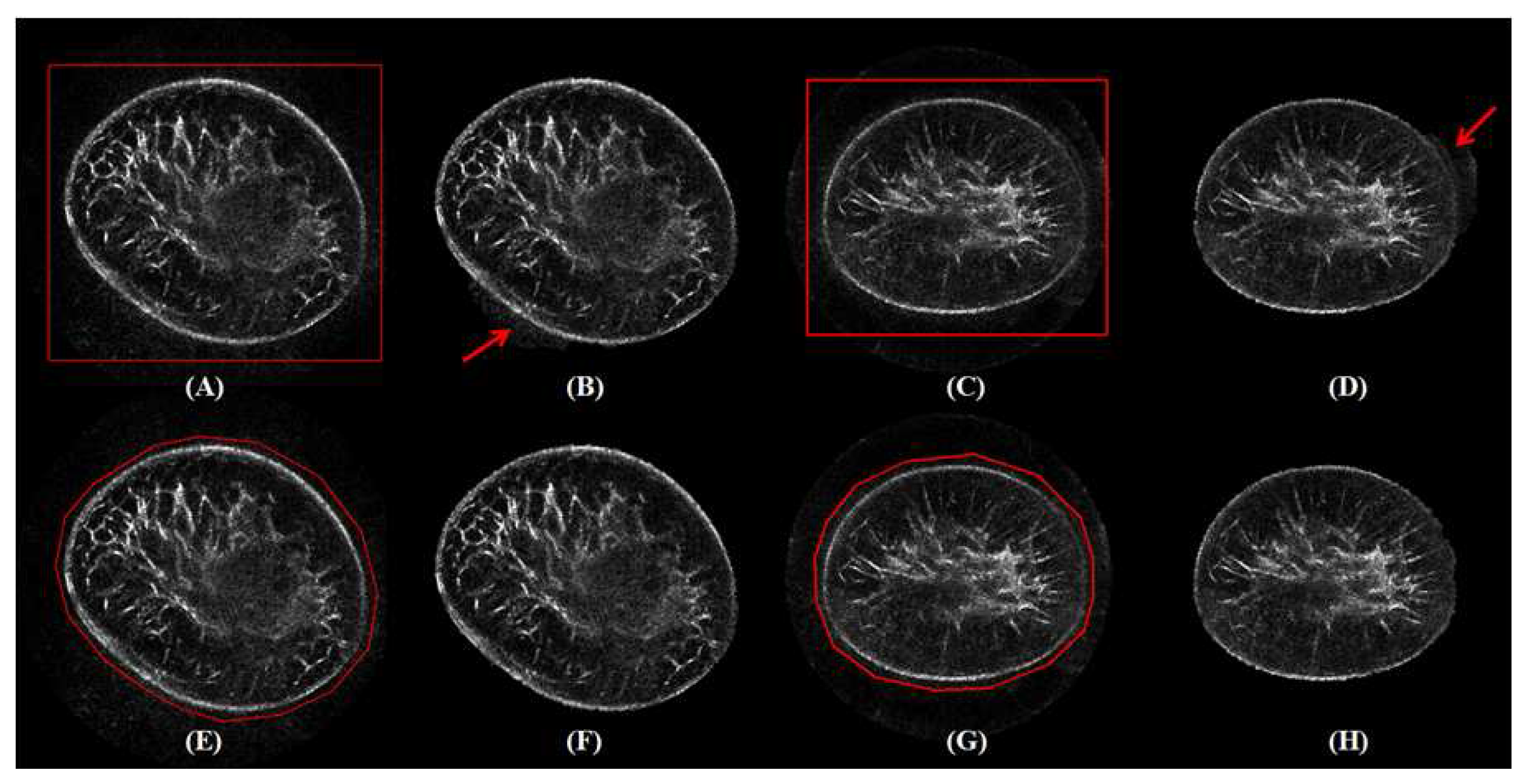 Sensors 17 01827 g007