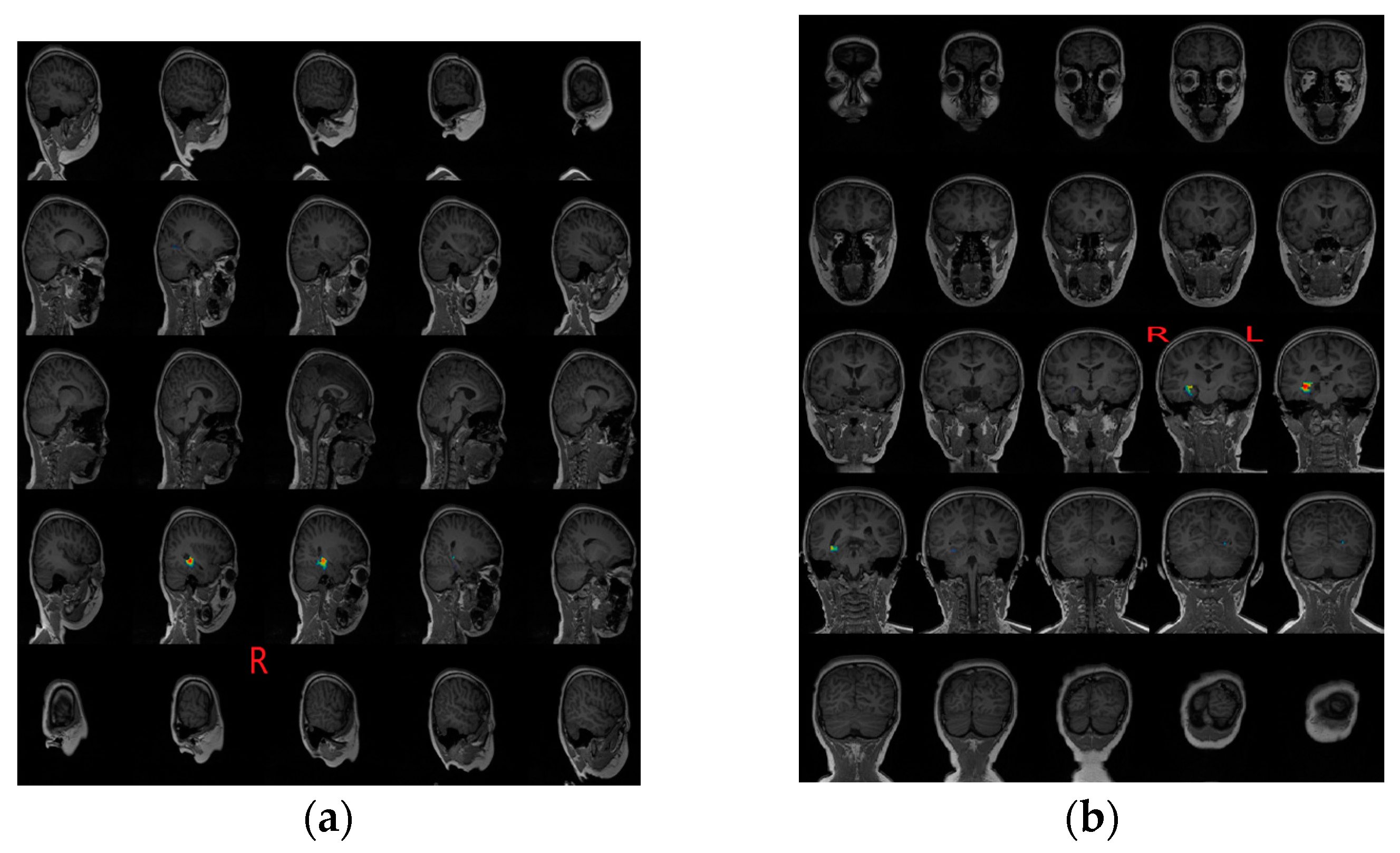 Sensors 17 01860 g007