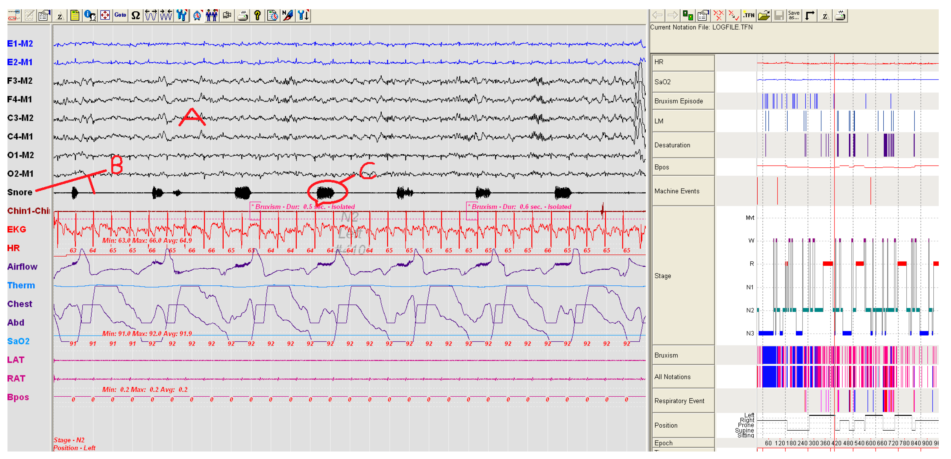Sensors 17 02006 g007