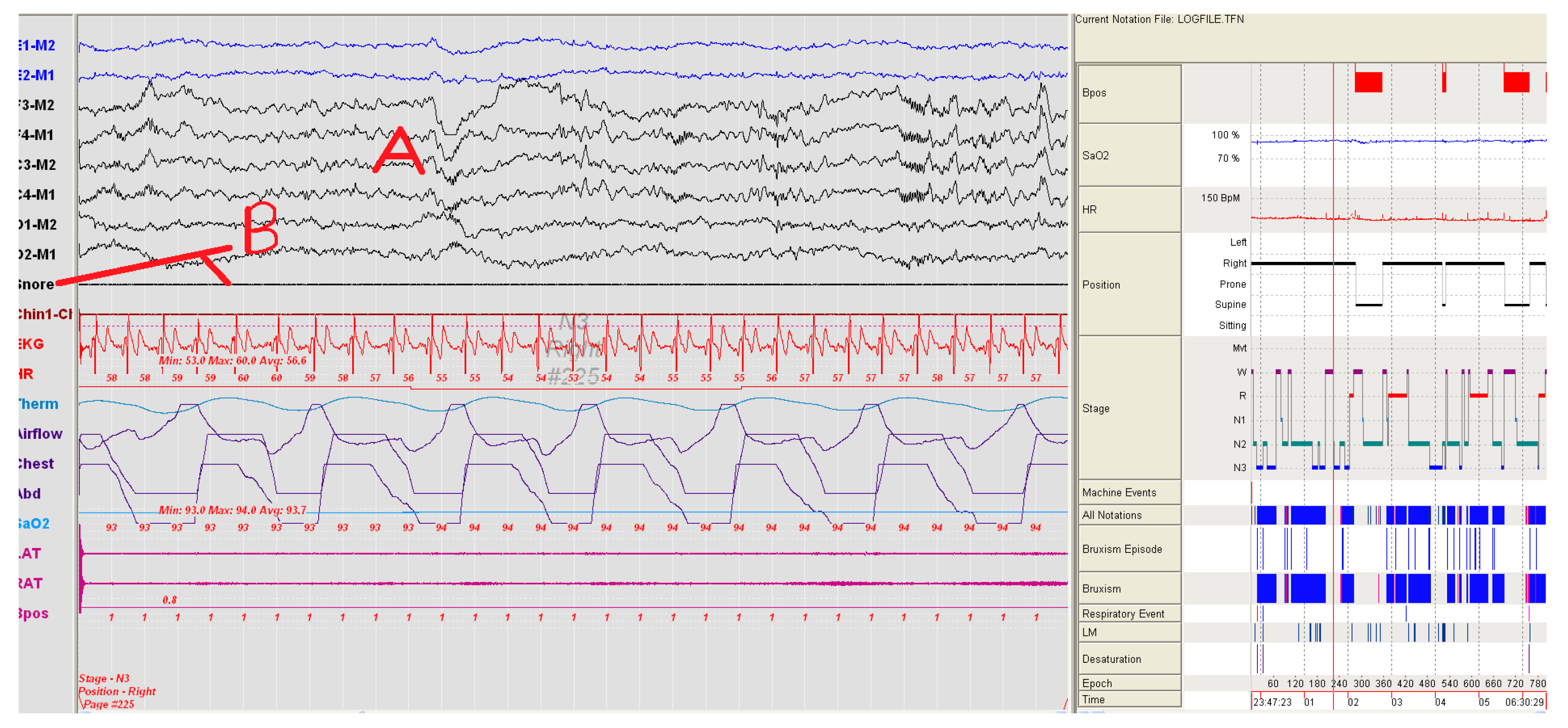 Sensors 17 02006 g008