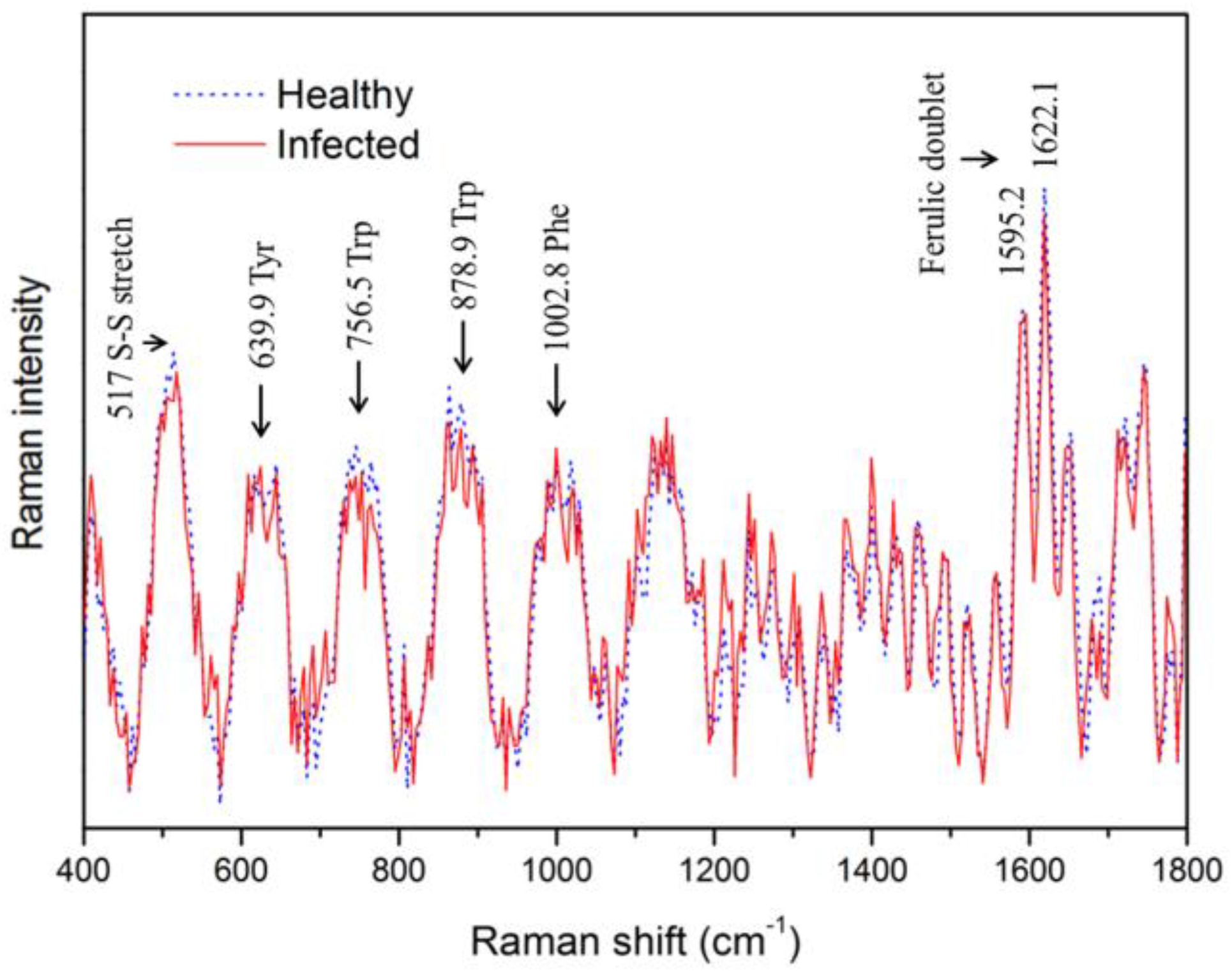 Sensors 17 02188 g005 Sensors 17 02188 g005