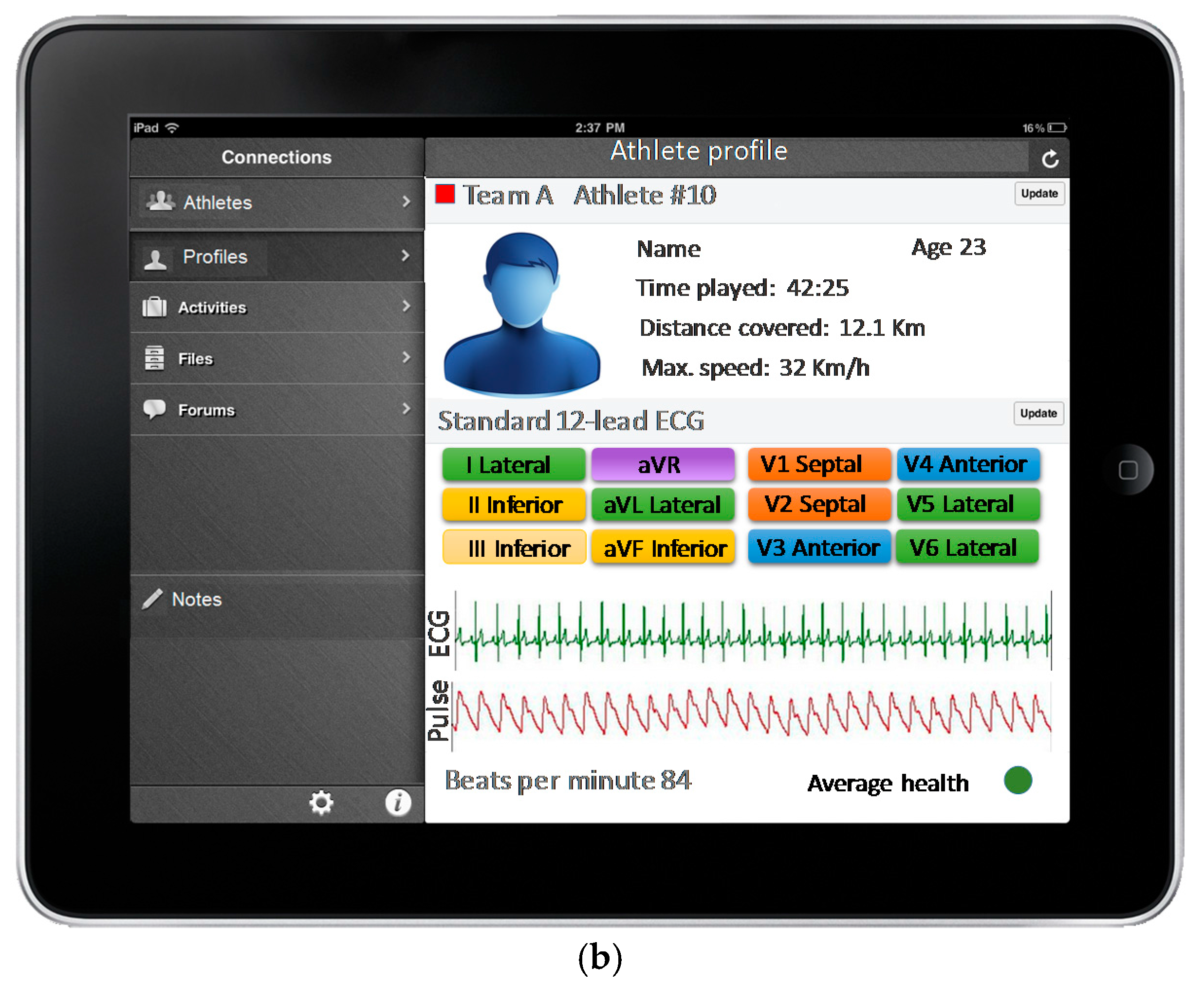 Sensors 17 02302 g005b