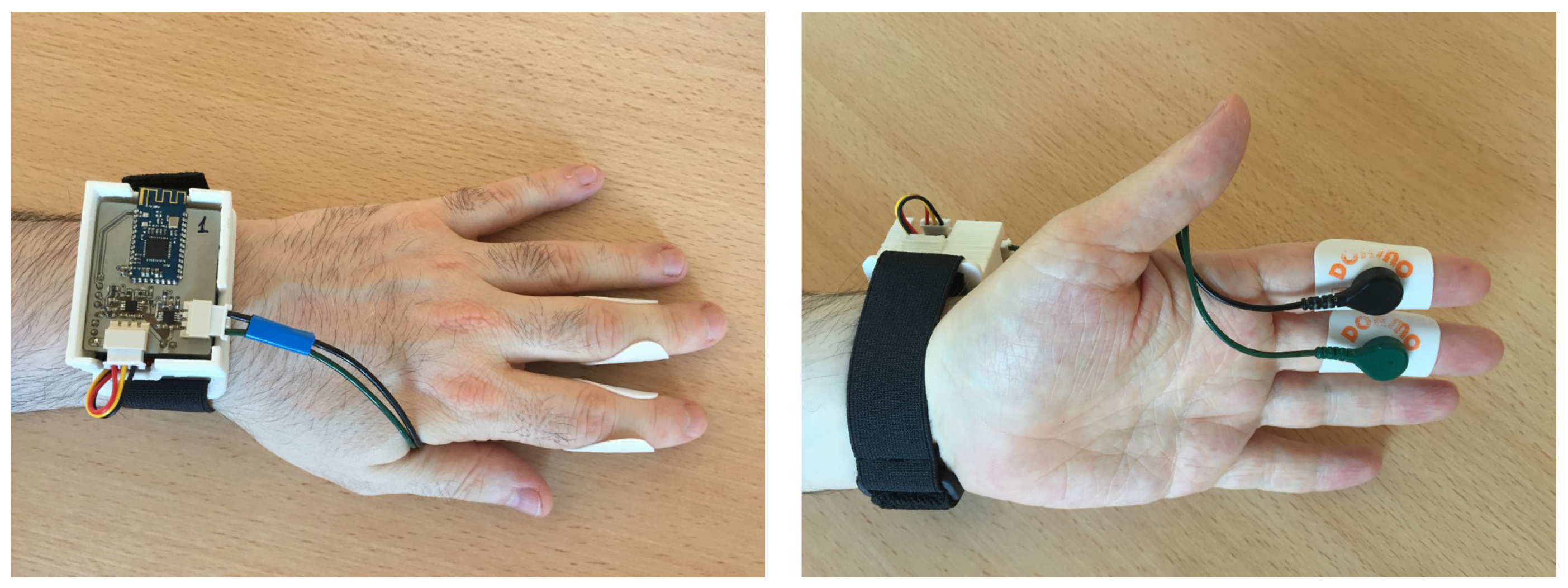 Sensors 17 02324 g001 Sensors 17 02324 g001