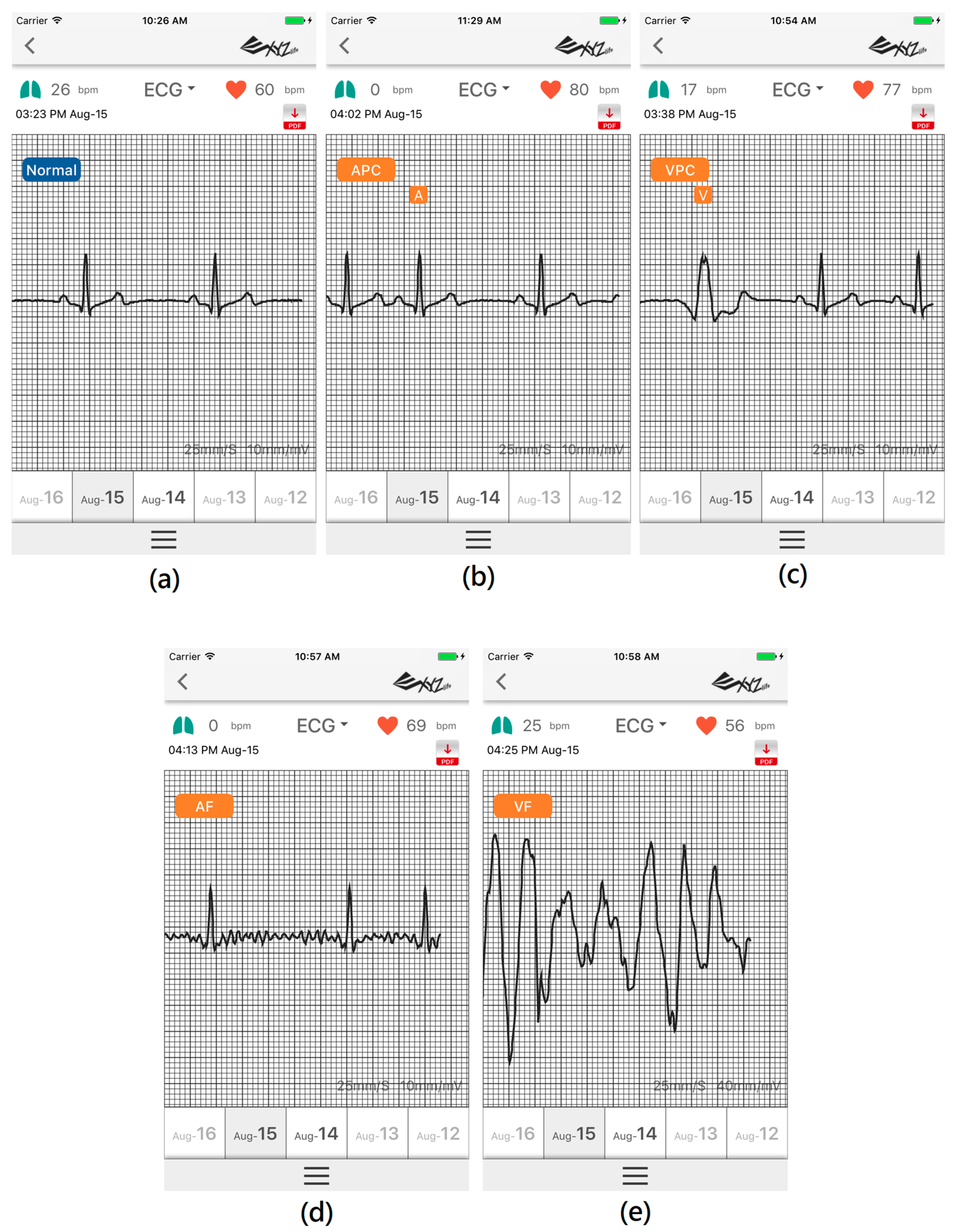 Sensors 17 02445 g004 Sensors 17 02445 g004