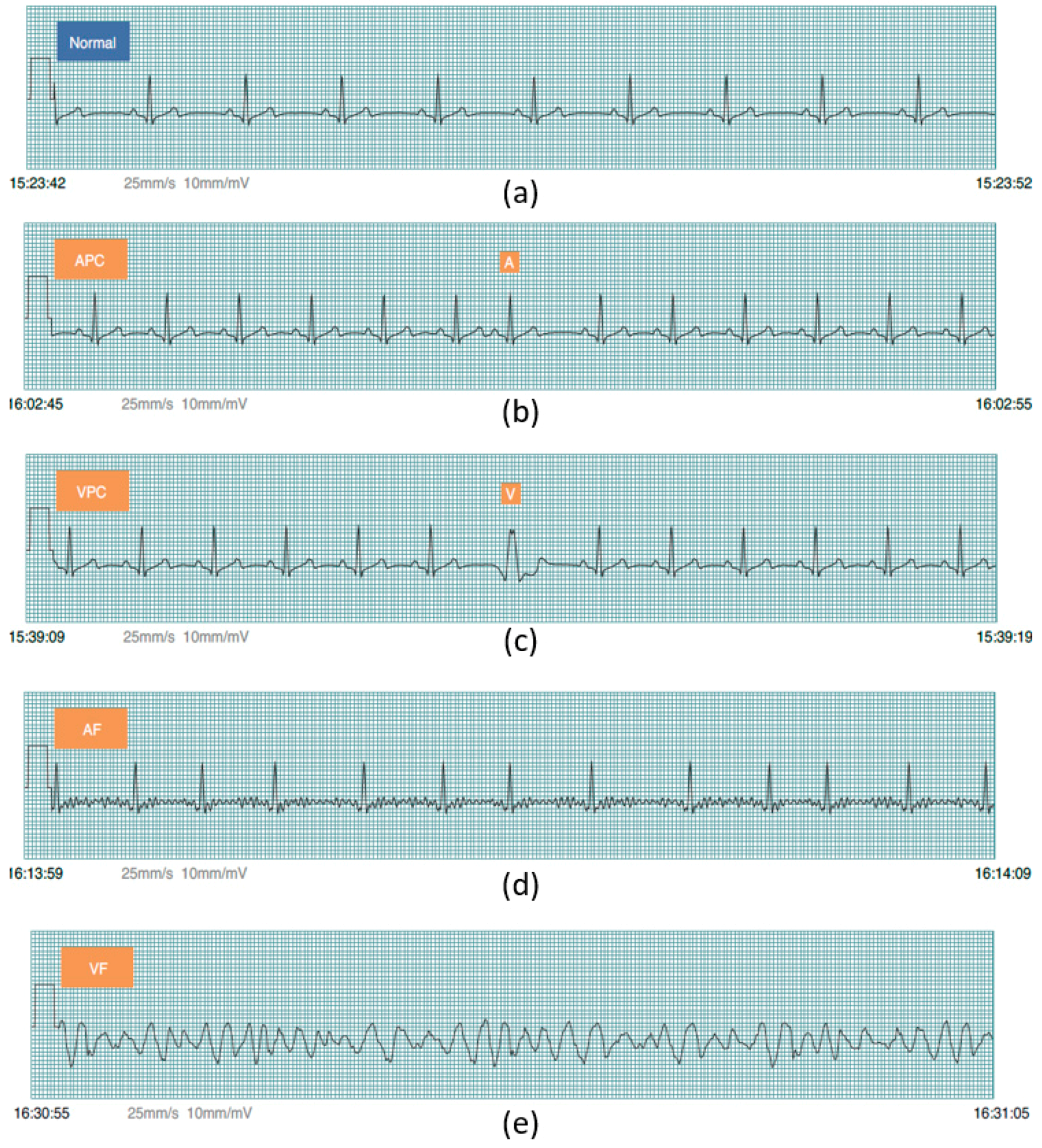 Sensors 17 02445 g005 Sensors 17 02445 g005