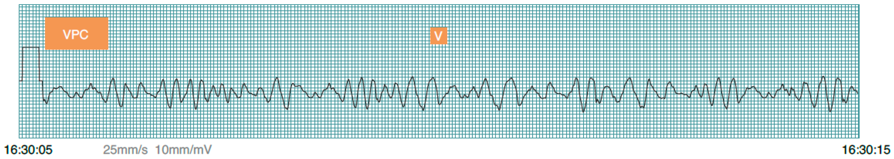 Sensors 17 02445 g006 Sensors 17 02445 g006