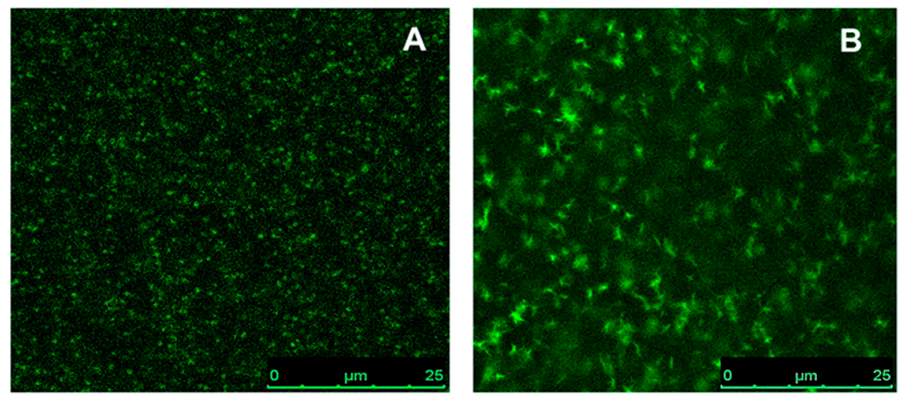 Sensors 17 02532 g008