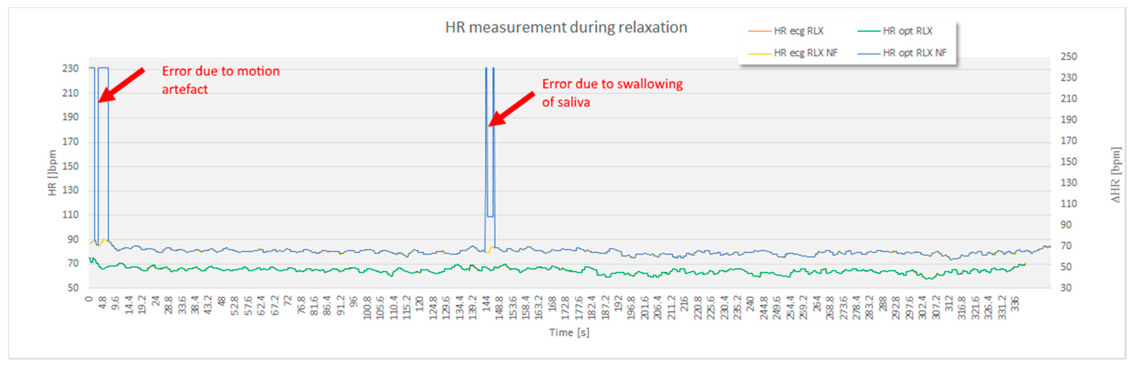 Sensors 17 02637 g007