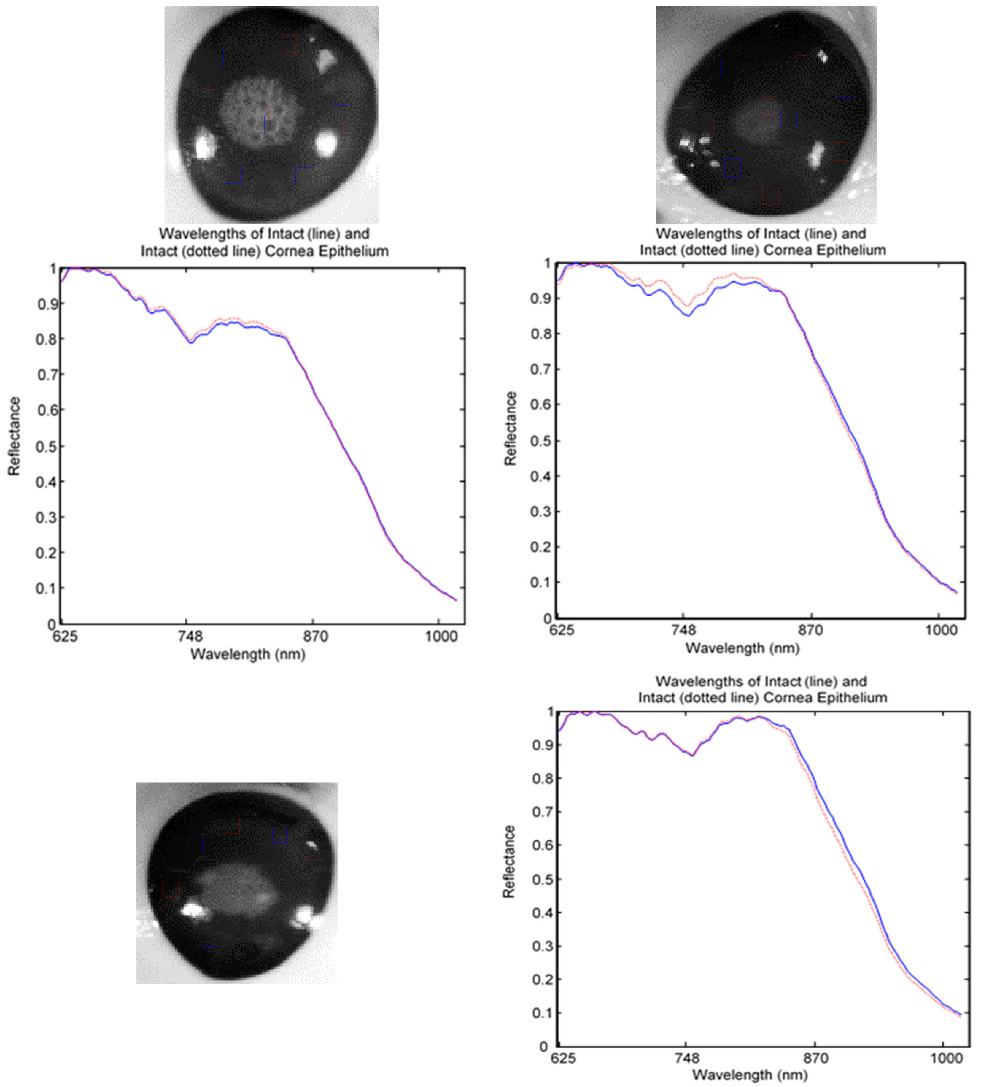 Sensors 17 02644 g008
