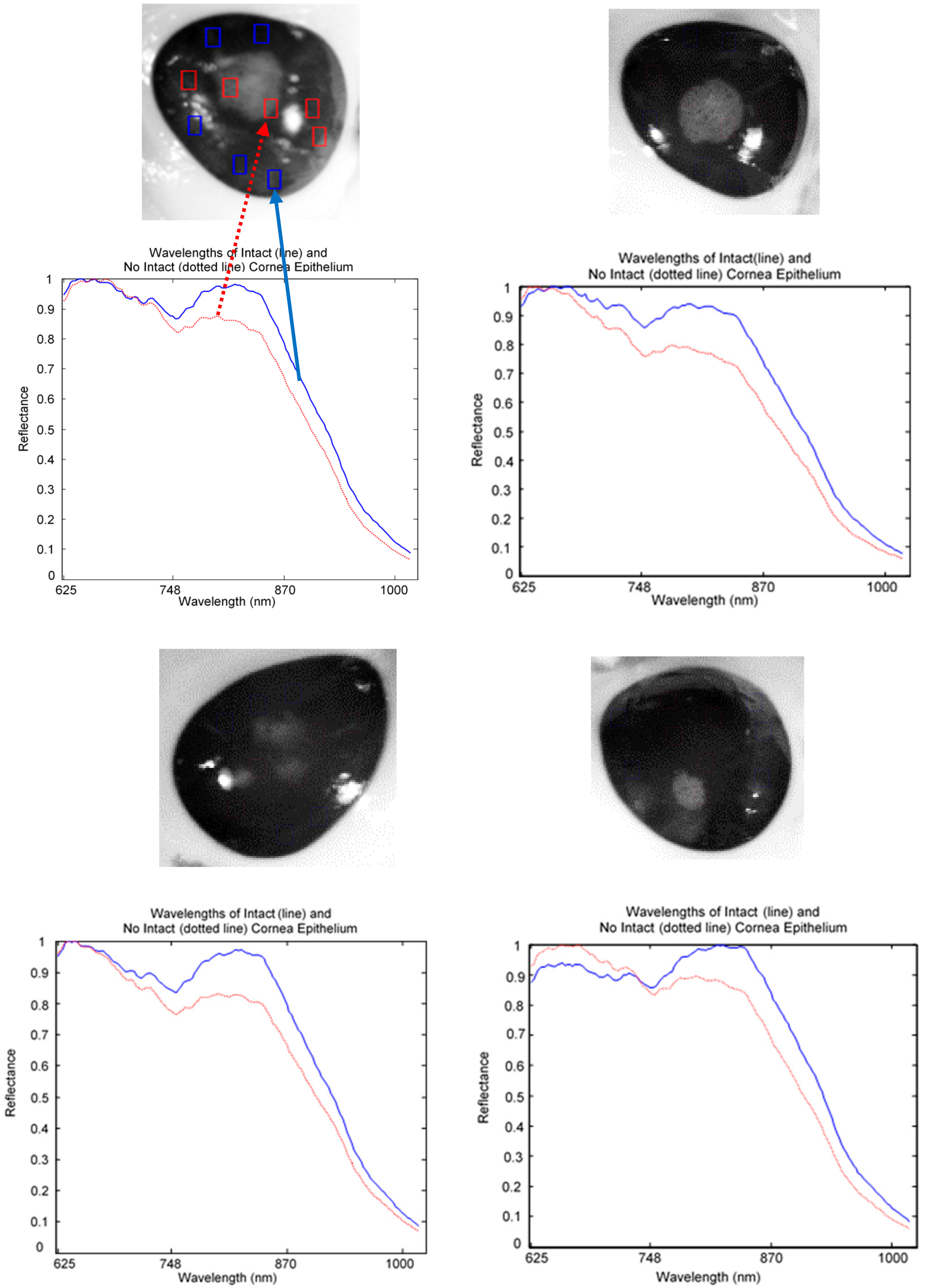 Sensors 17 02644 g009