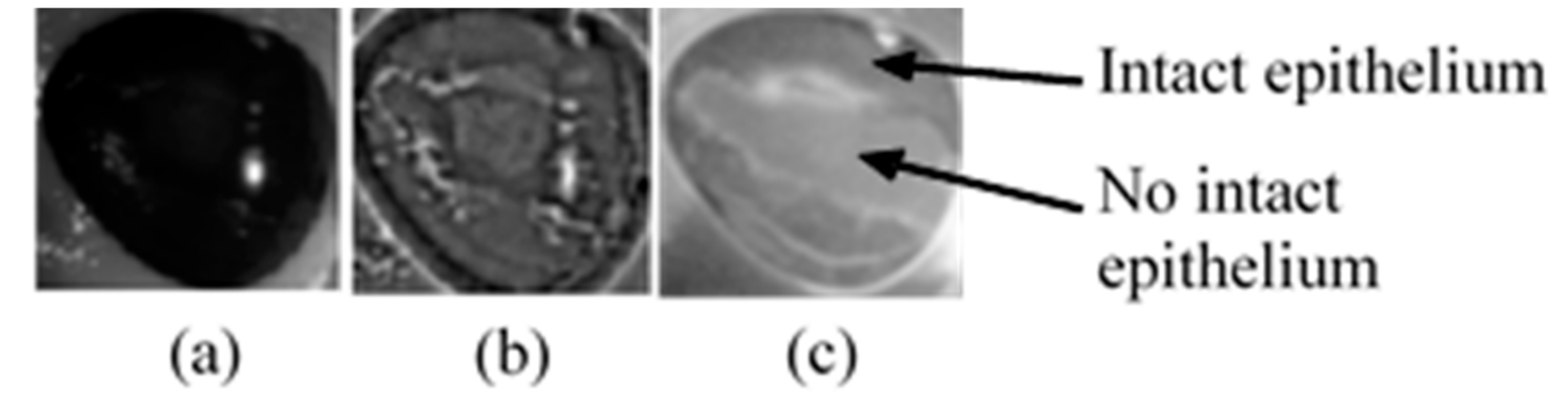 Sensors 17 02644 g016