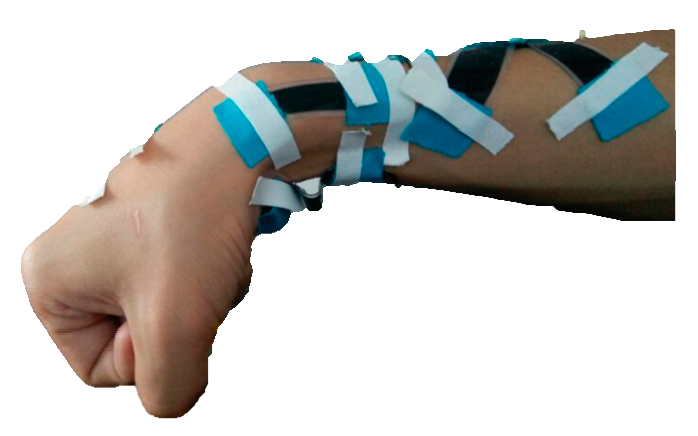 Sensors 17 02708 g008