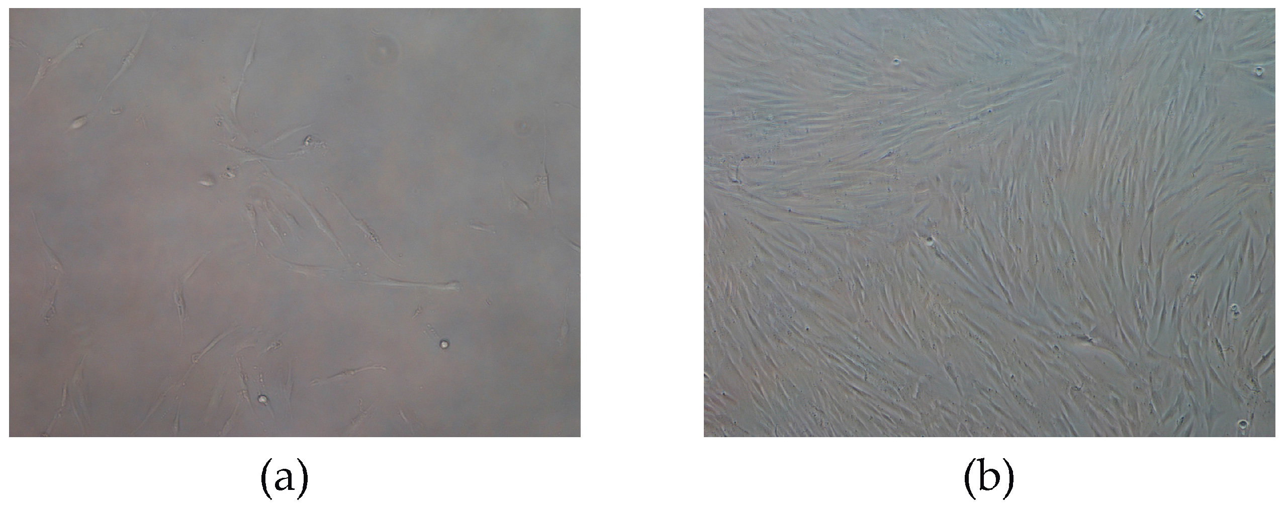 Sensors 17 02747 g008