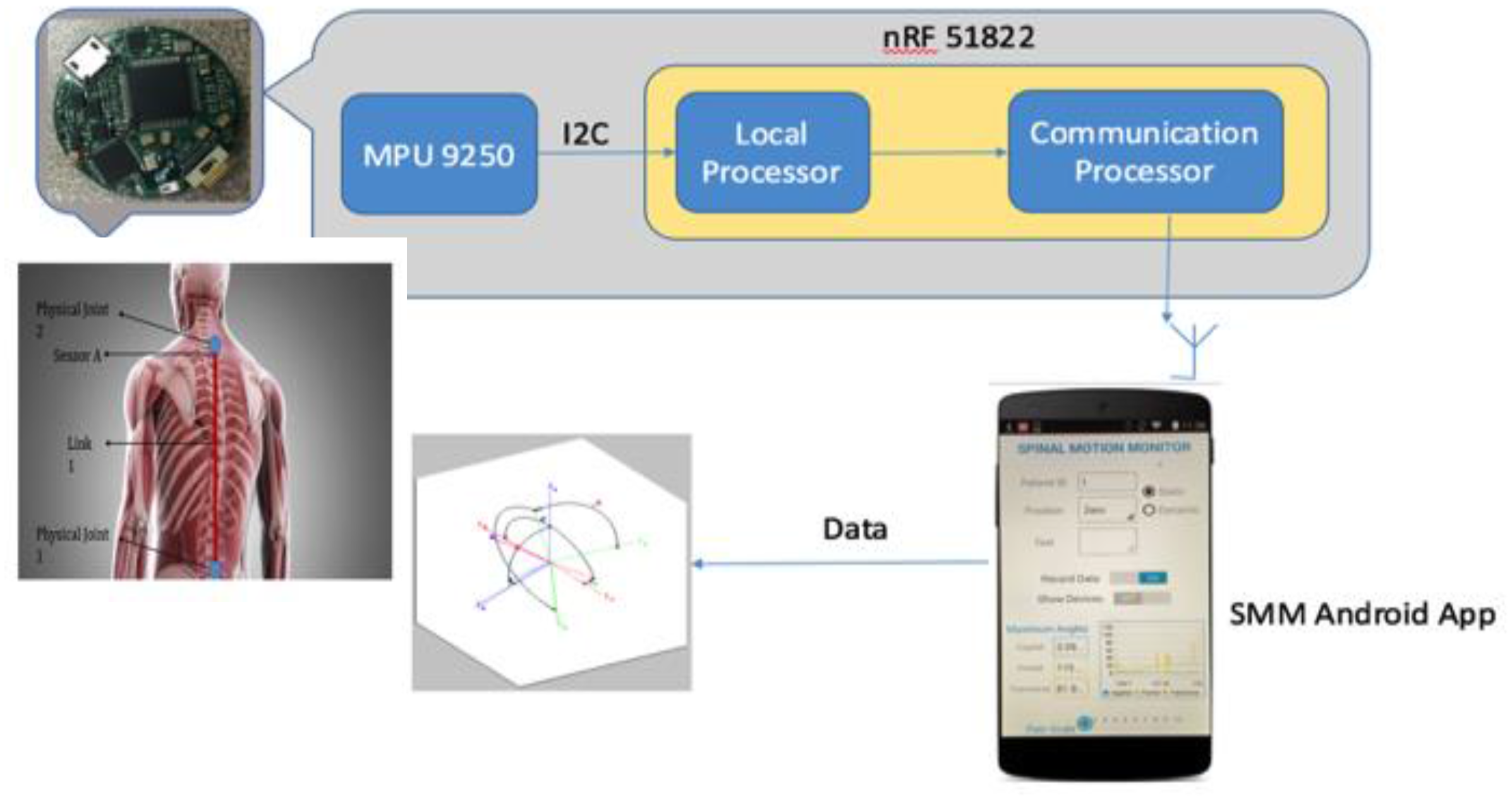 Sensors 17 02932 g001