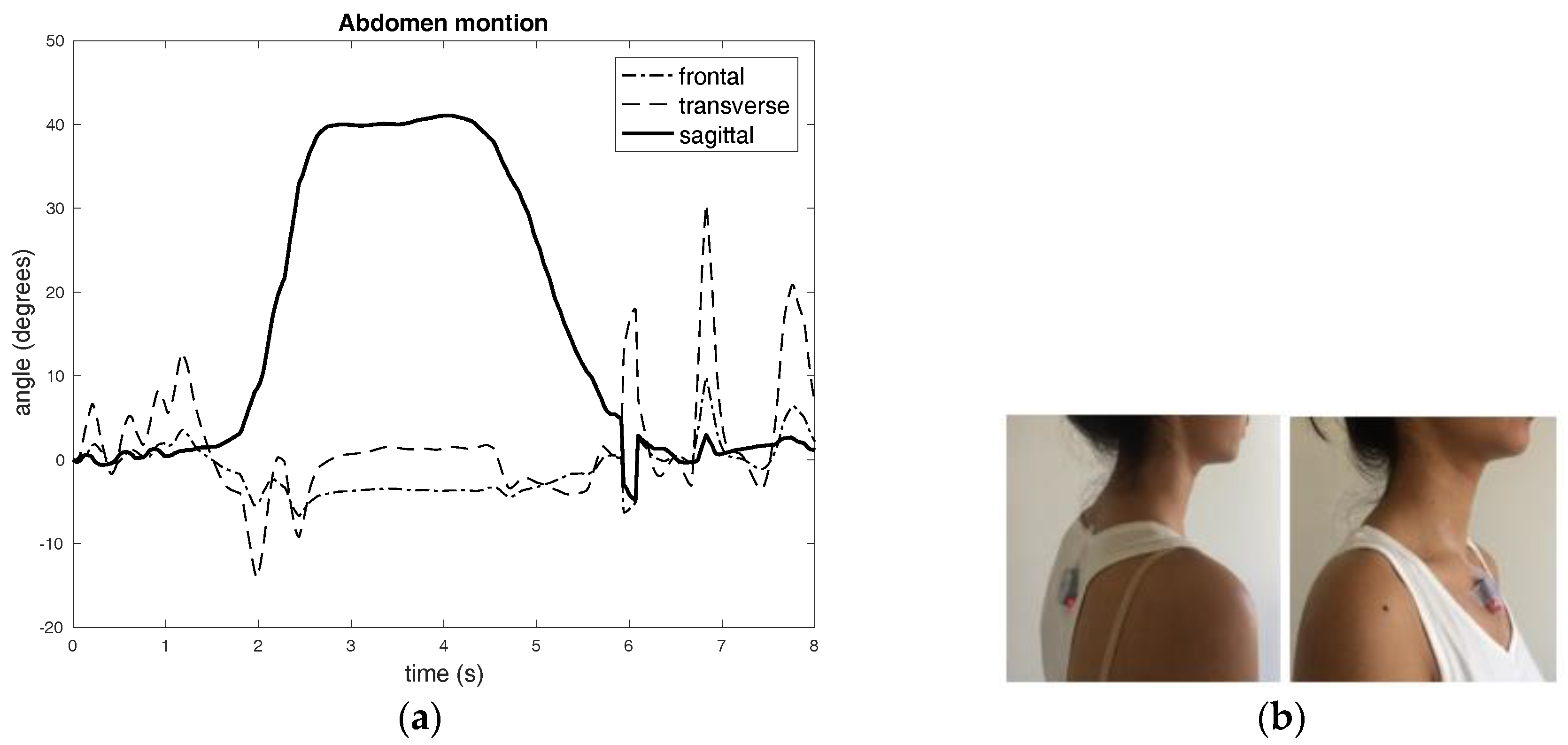 Sensors 17 02932 g005a