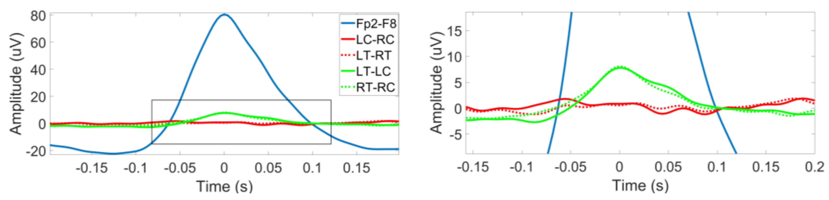 Sensors 18 00029 g005