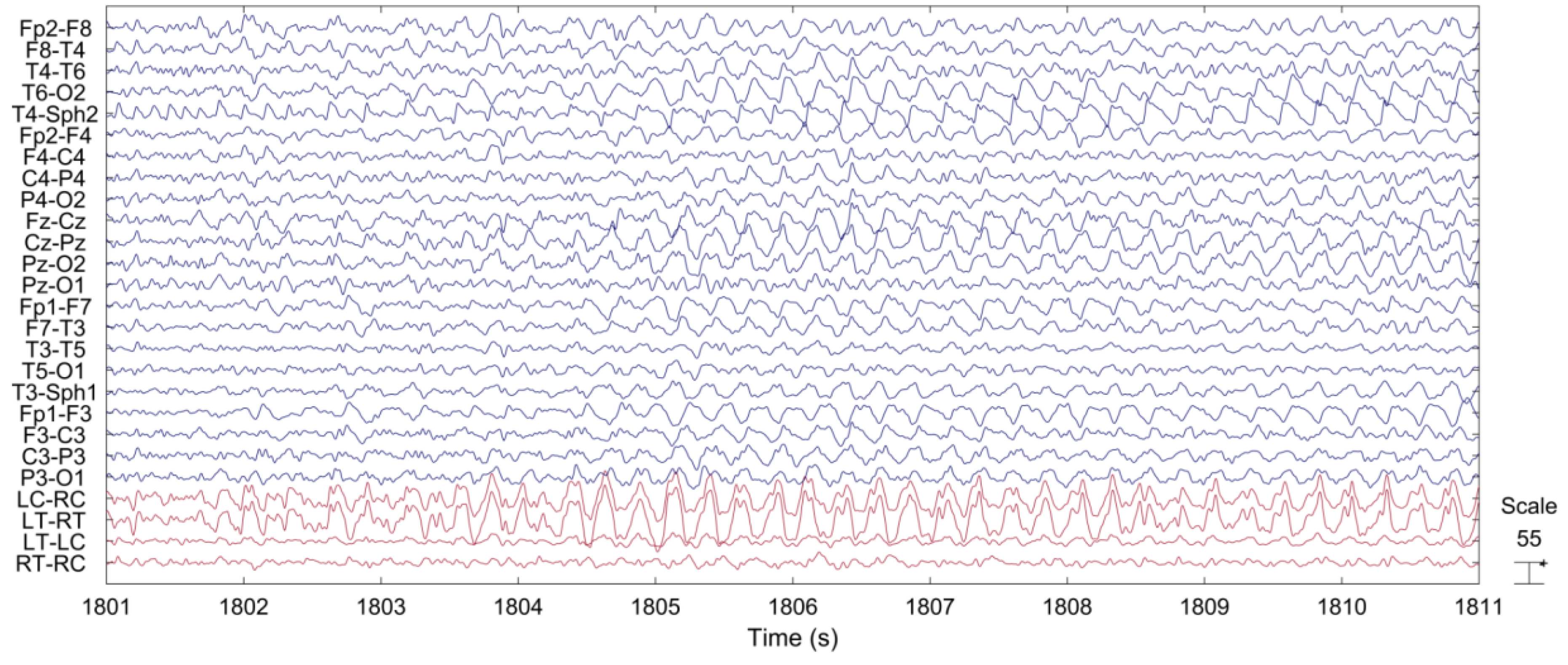 Sensors 18 00029 g006