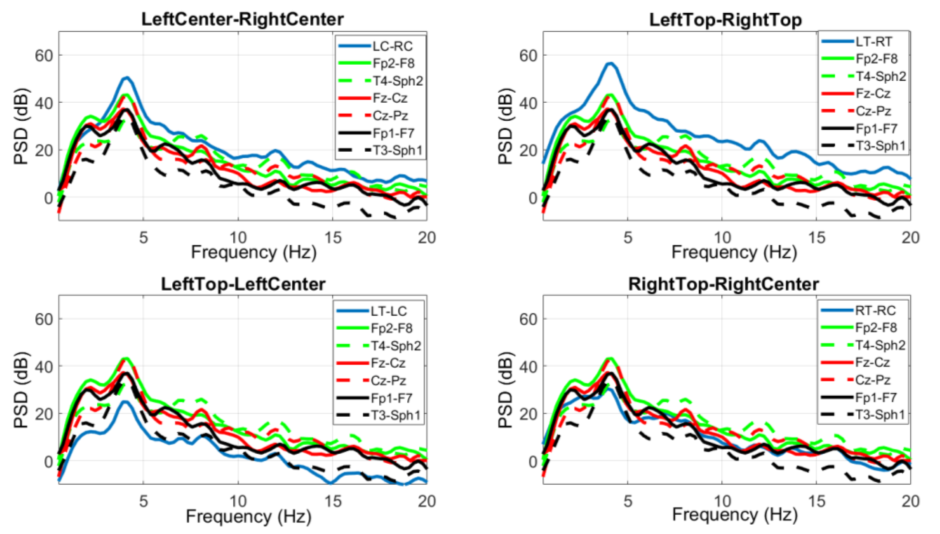 Sensors 18 00029 g007
