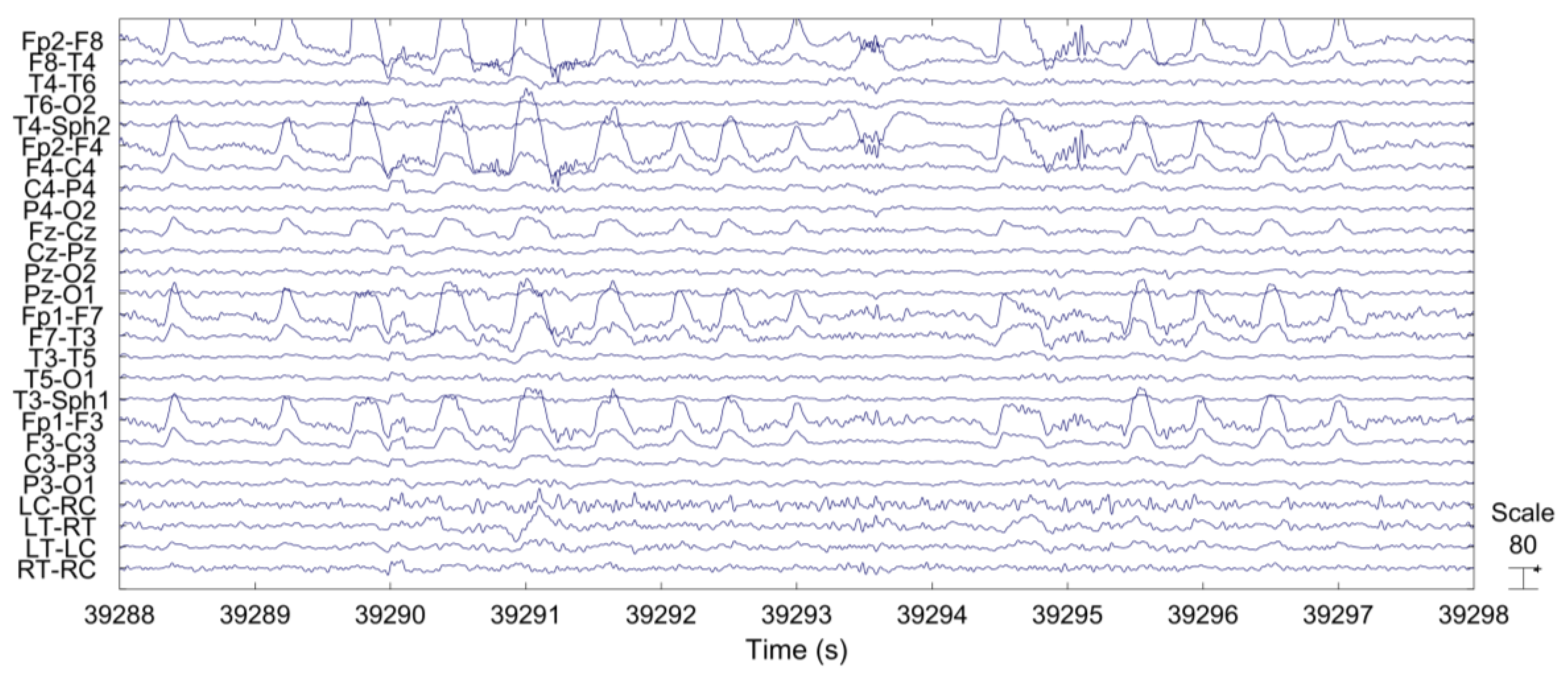 Sensors 18 00029 g009
