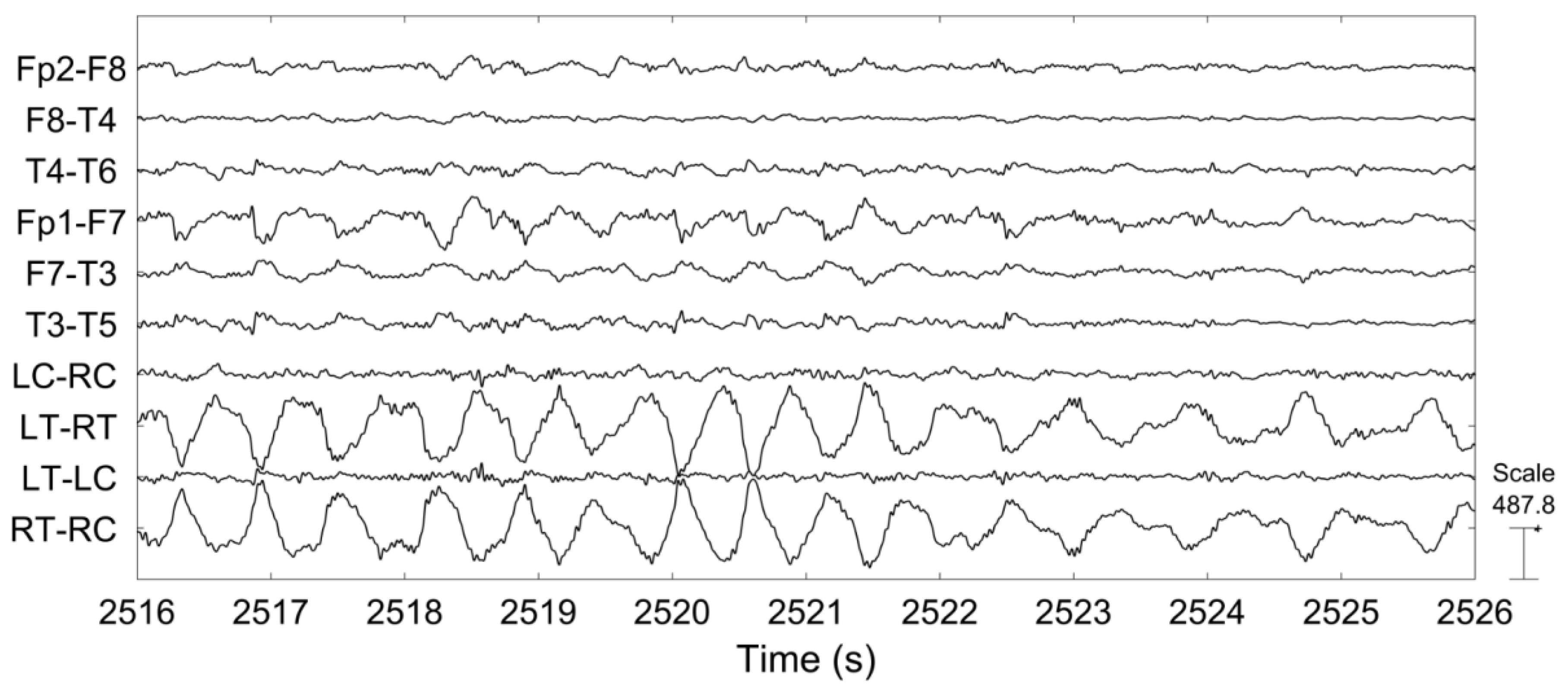 Sensors 18 00029 g010