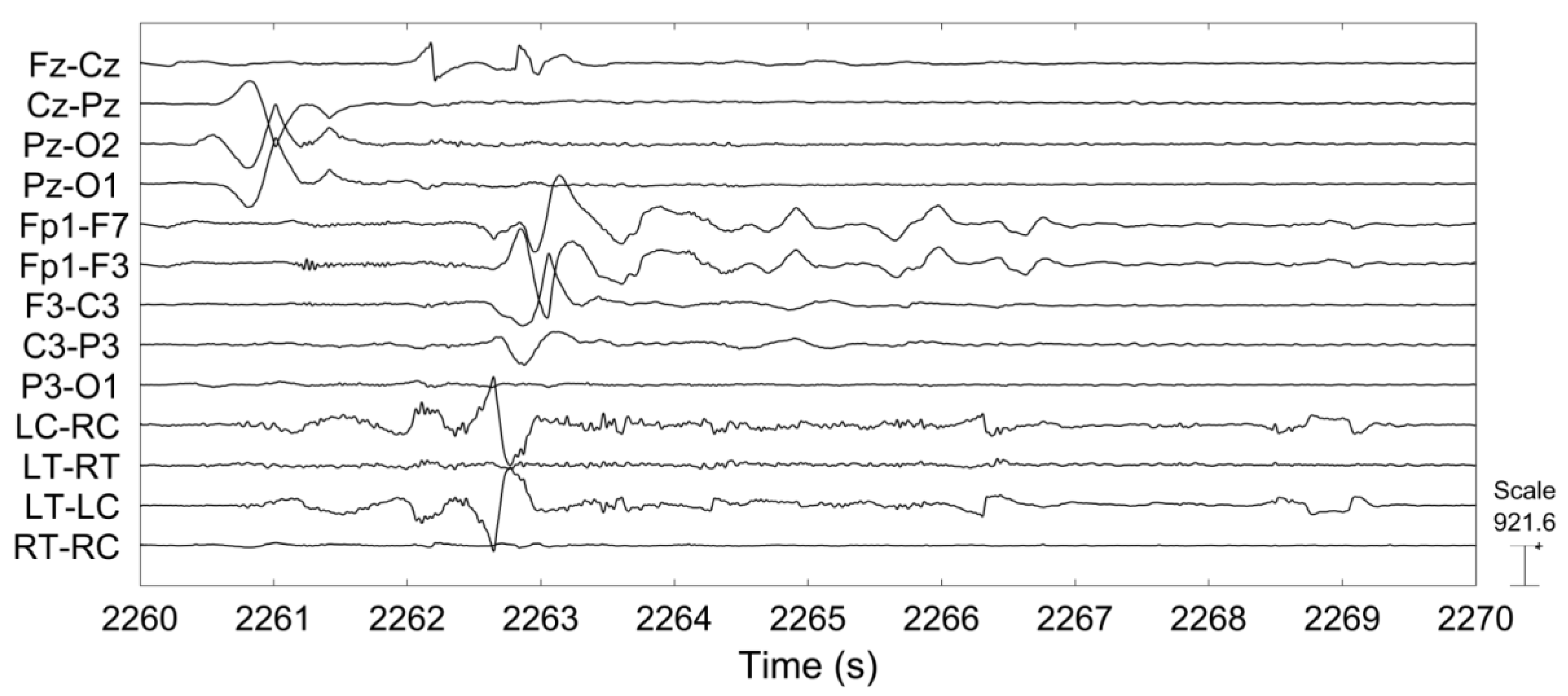 Sensors 18 00029 g011