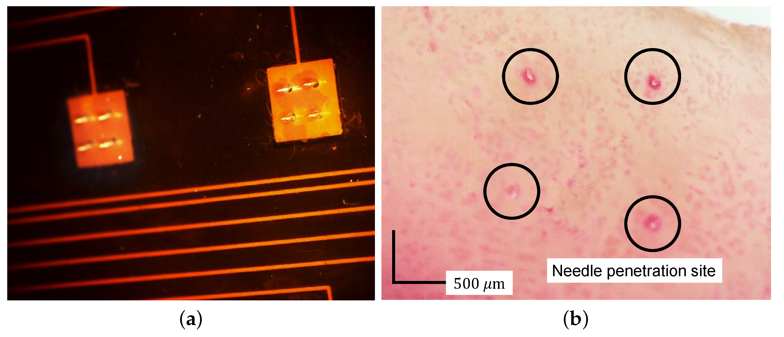 Sensors 18 00092 g005