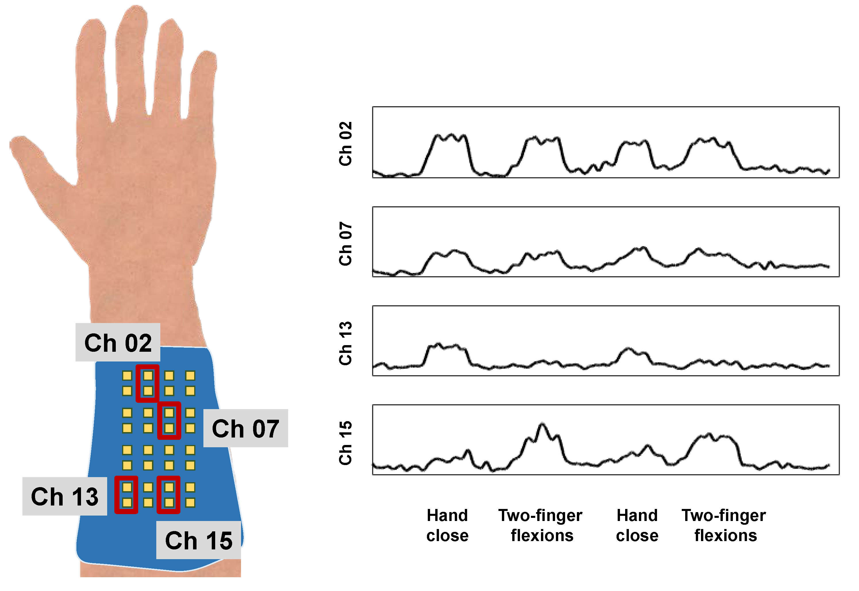 Sensors 18 00092 g010