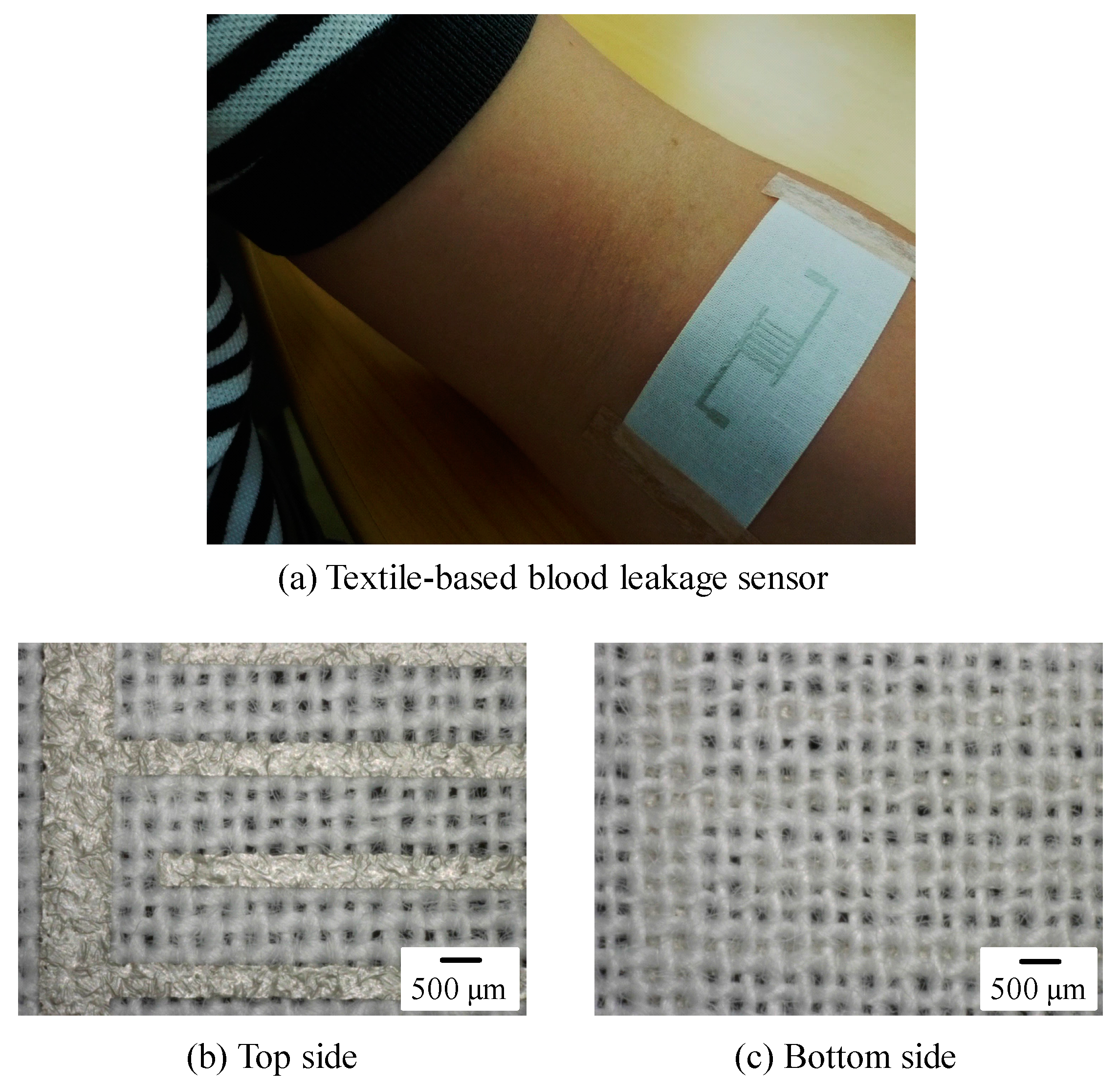 Sensors 18 00240 g002