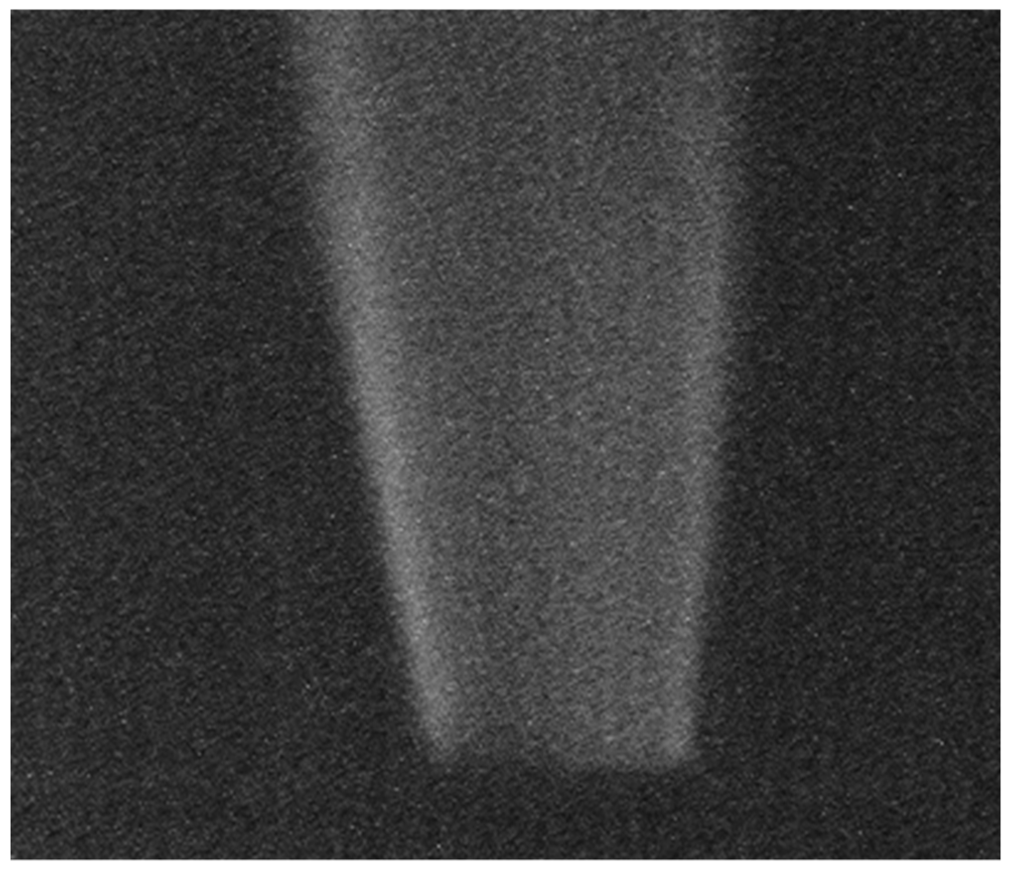 Sensors 18 00314 g009
