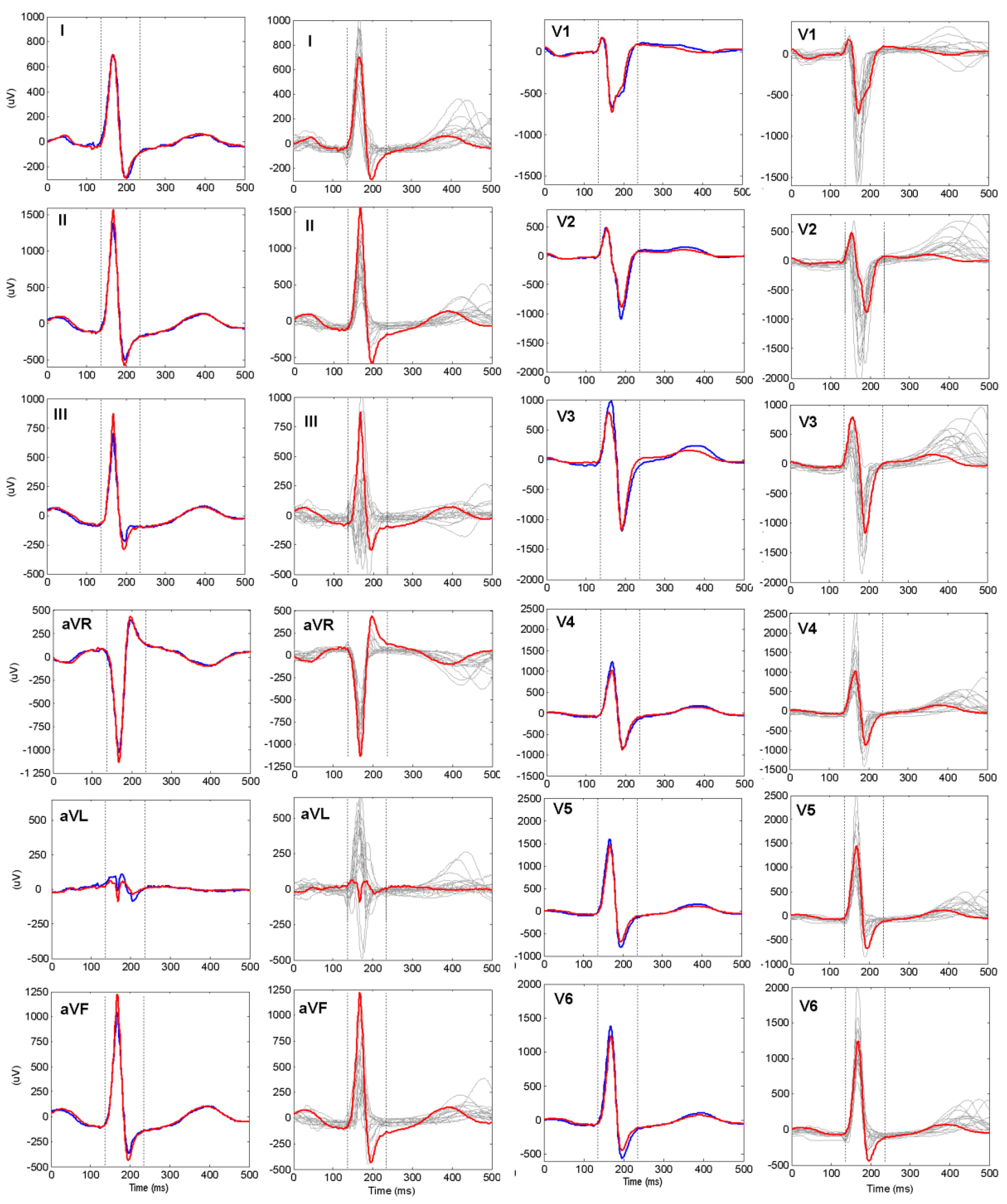 Sensors 18 00372 g003