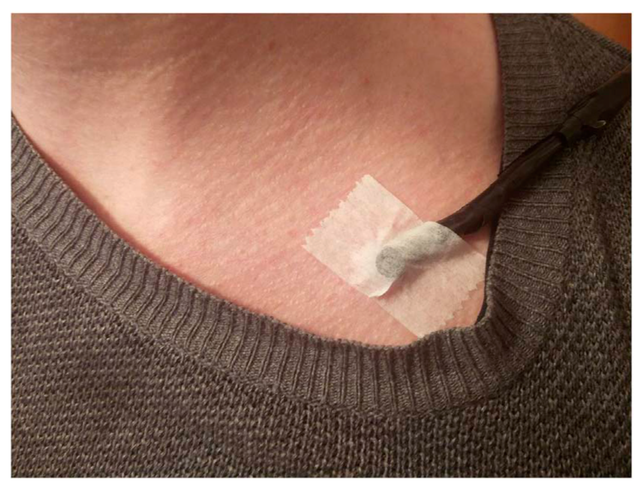 Sensors 18 00594 g004