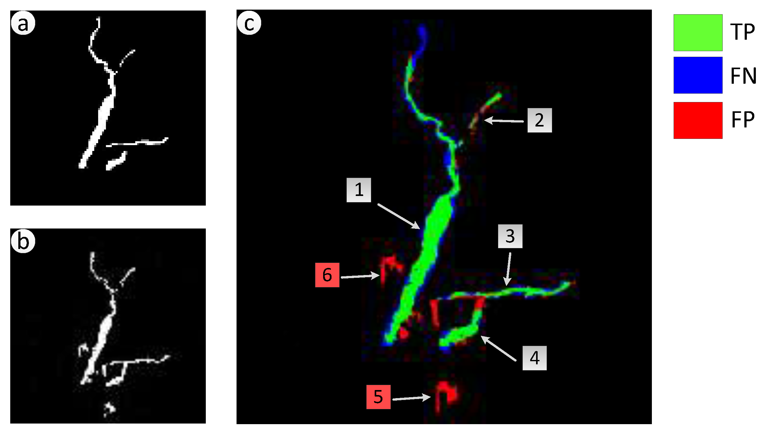 Sensors 18 00821 g011 Sensors 18 00821 g011