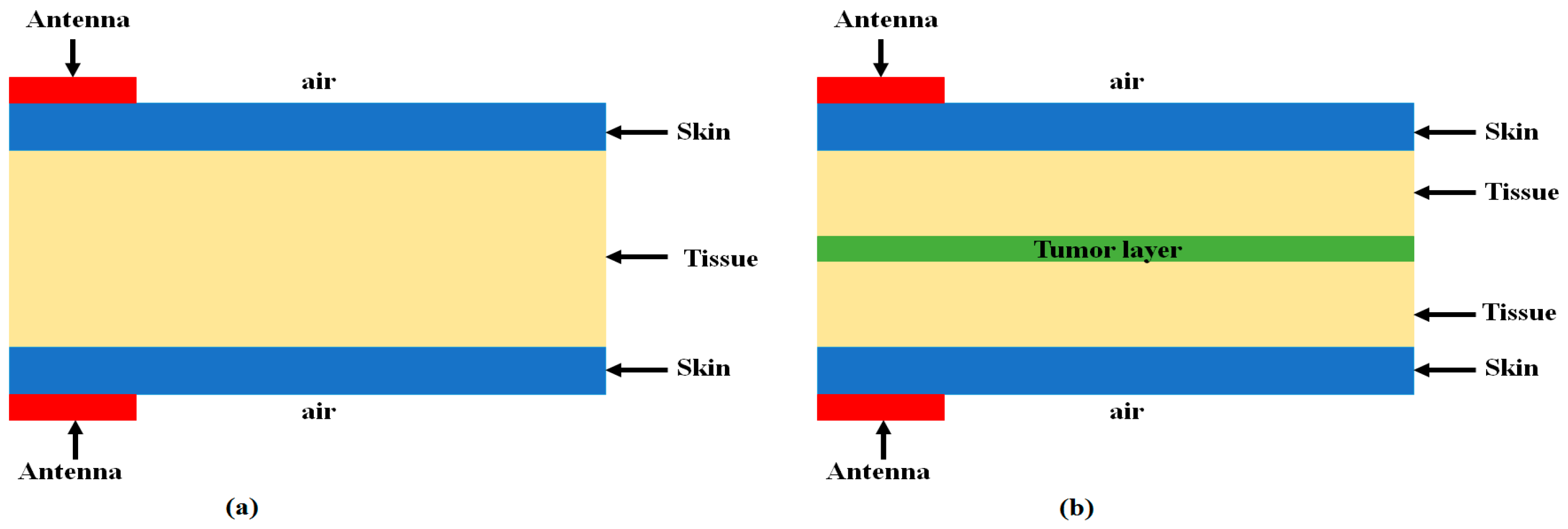 Sensors 18 00911 g012