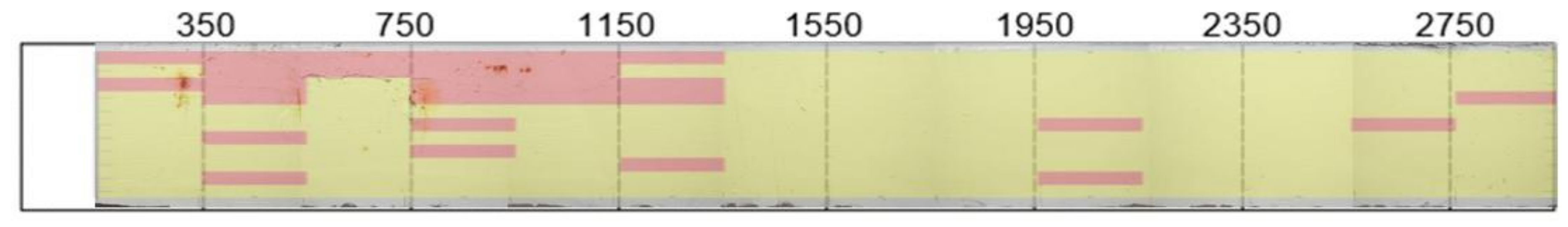 Sensors 18 01018 g011