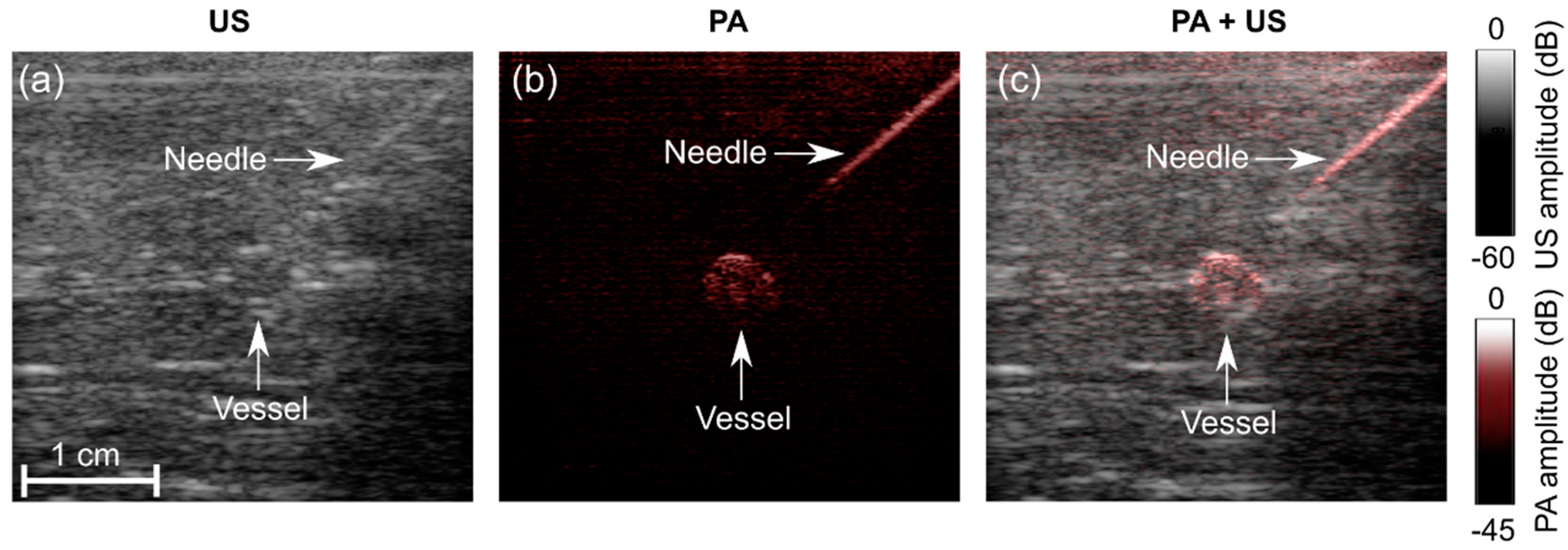 Sensors 18 01394 g005
