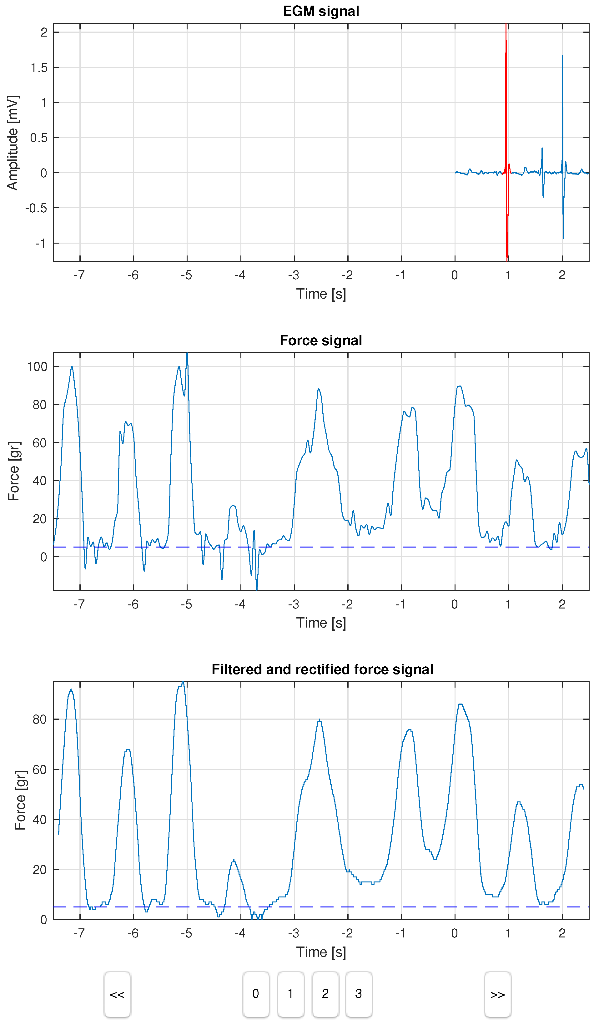 Sensors 18 01399 g001